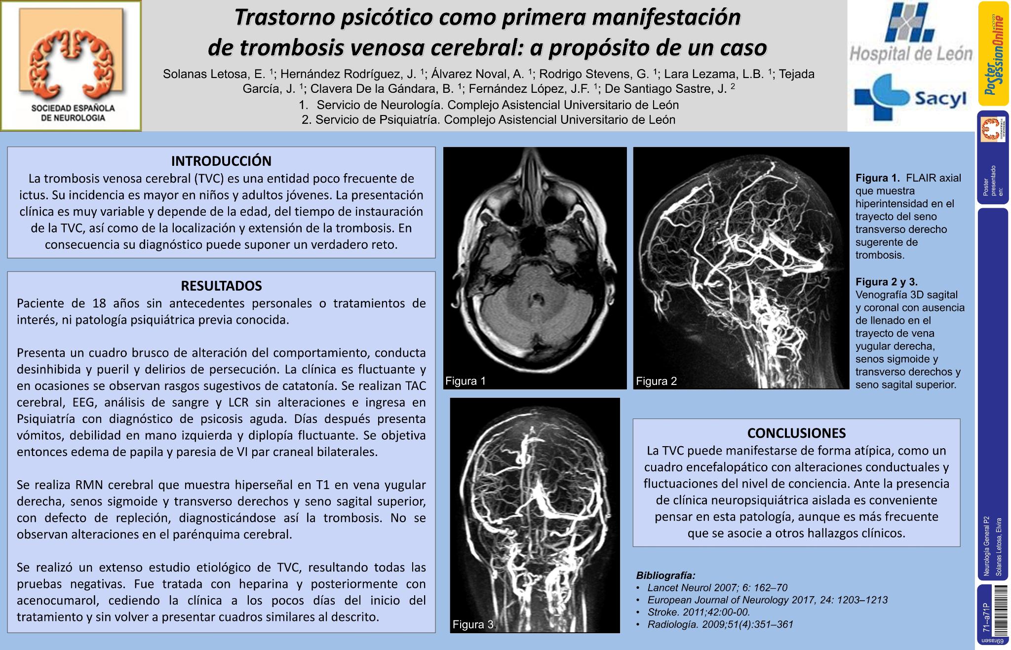 Trastorno psicótico como primera manifestación de trombosis venosa cerebral: a propósito de un caso