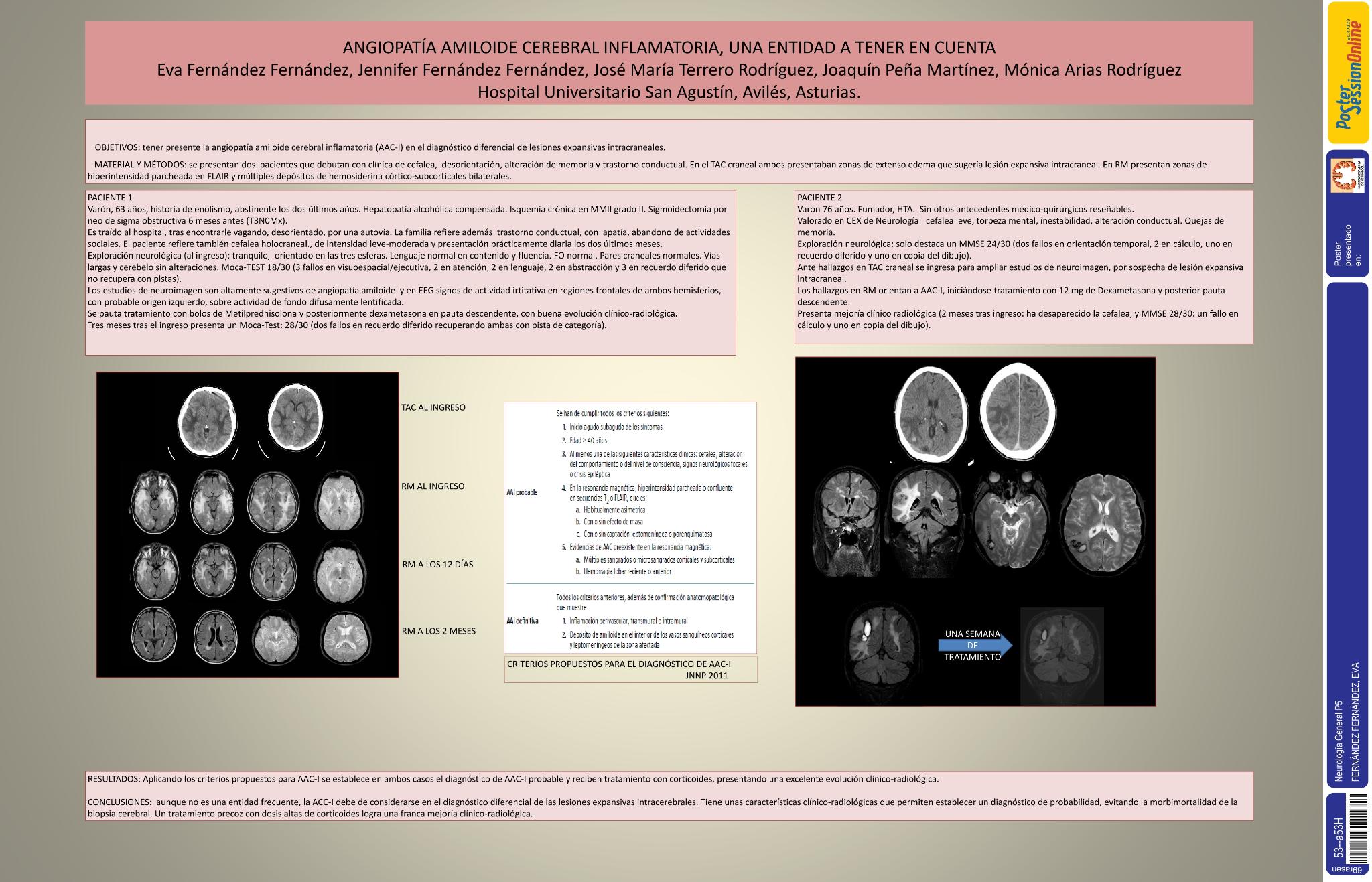 Angiopatía amiloide cerebral inflamatoria, una entidad a tener en cuenta