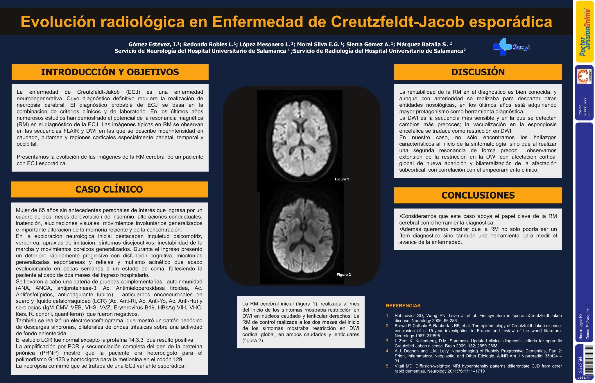 Evolución radiológica en enfermedad de Creutzfeldt-Jakob esporádica