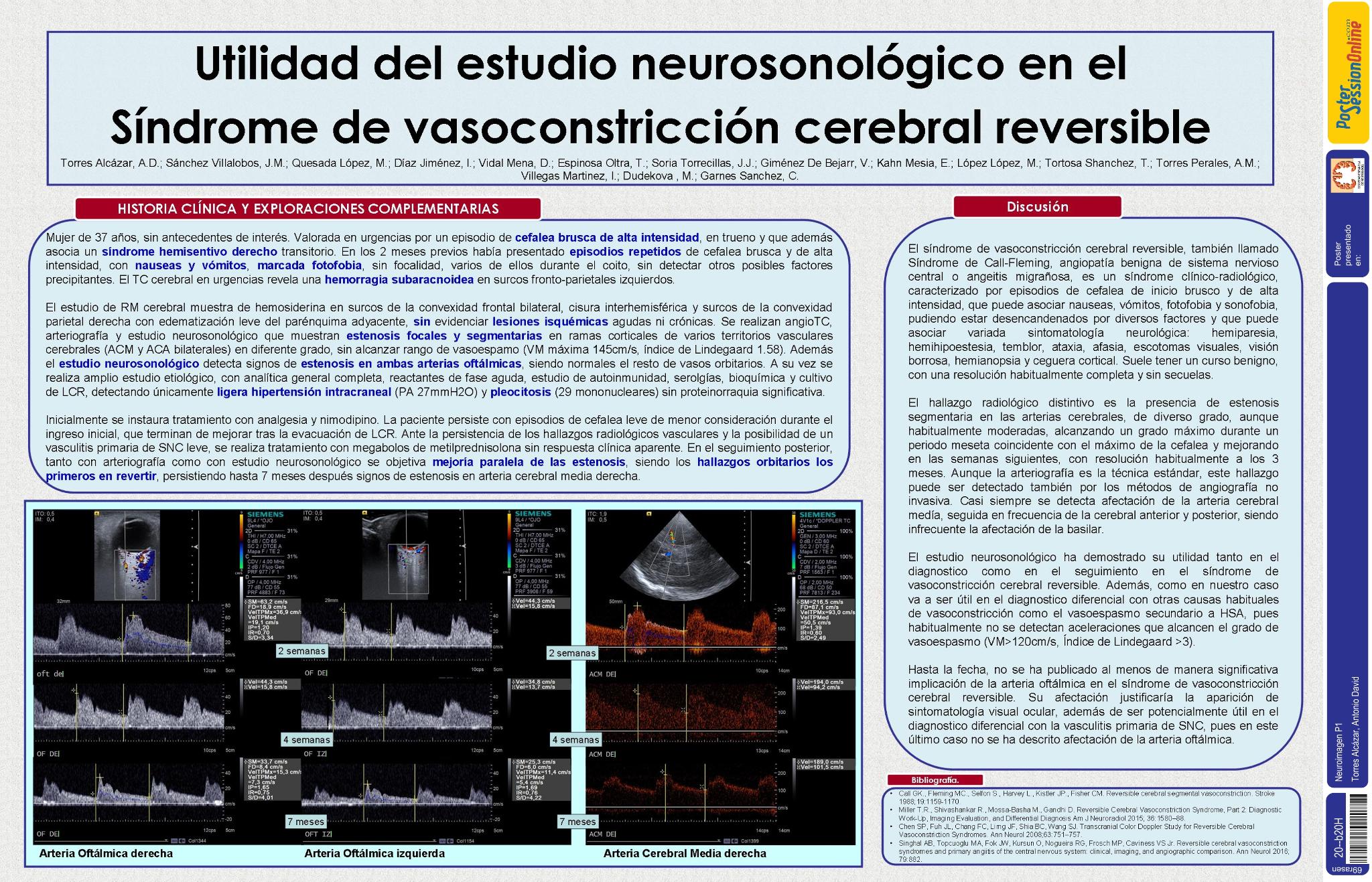 Utilidad del estudio neurosonológico en el síndrome de vasoconstricción cerebral reversible