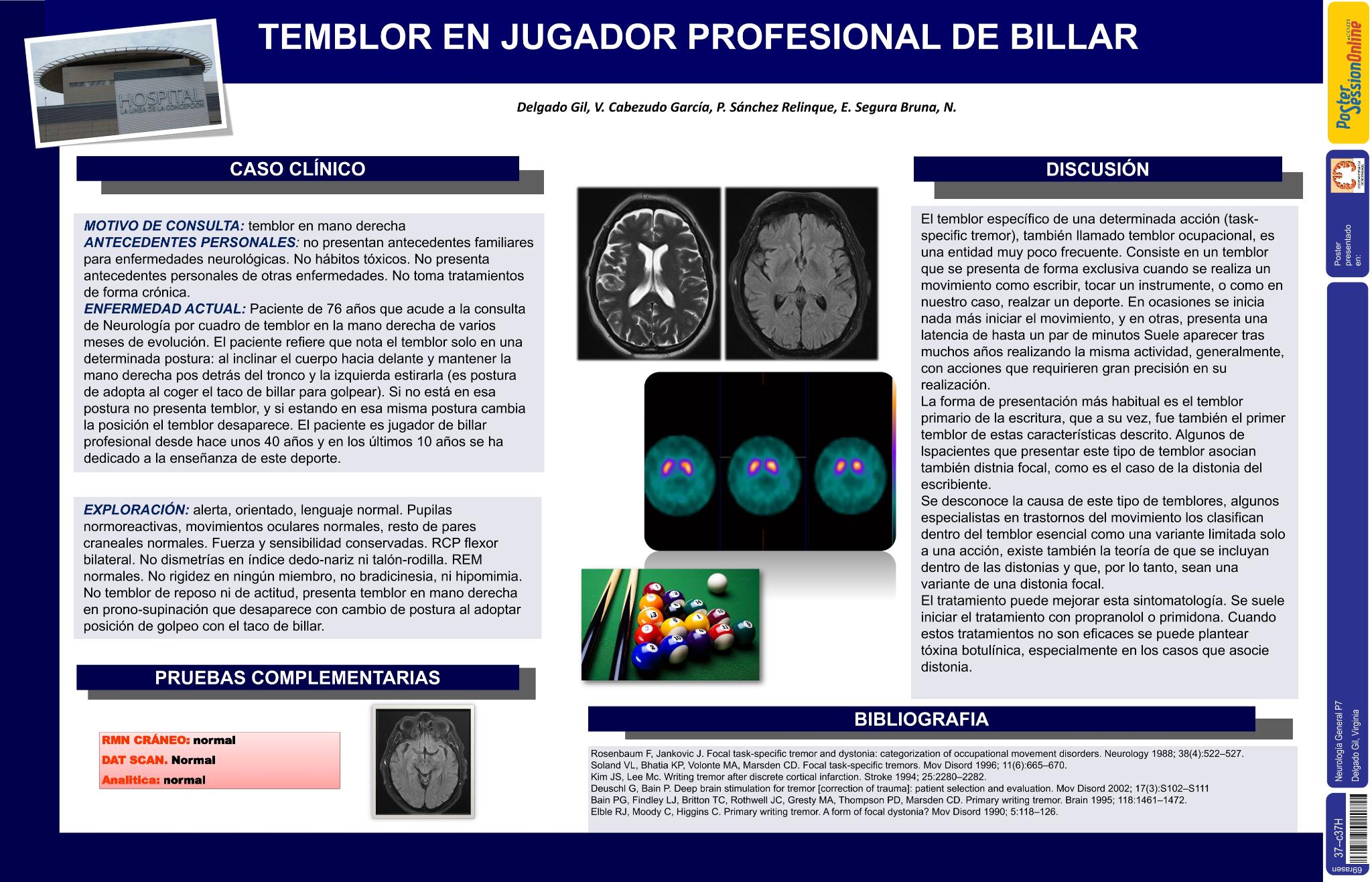 Temblor en jugador profesional de billar