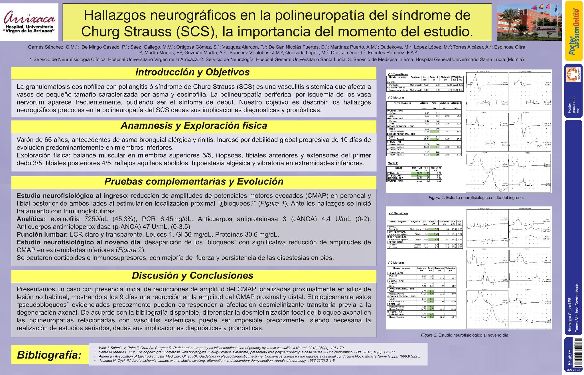 Hallazgos neurográficos en la polineuropatía del síndrome de Churg Strauss (SCS), la importancia del momento del estudio