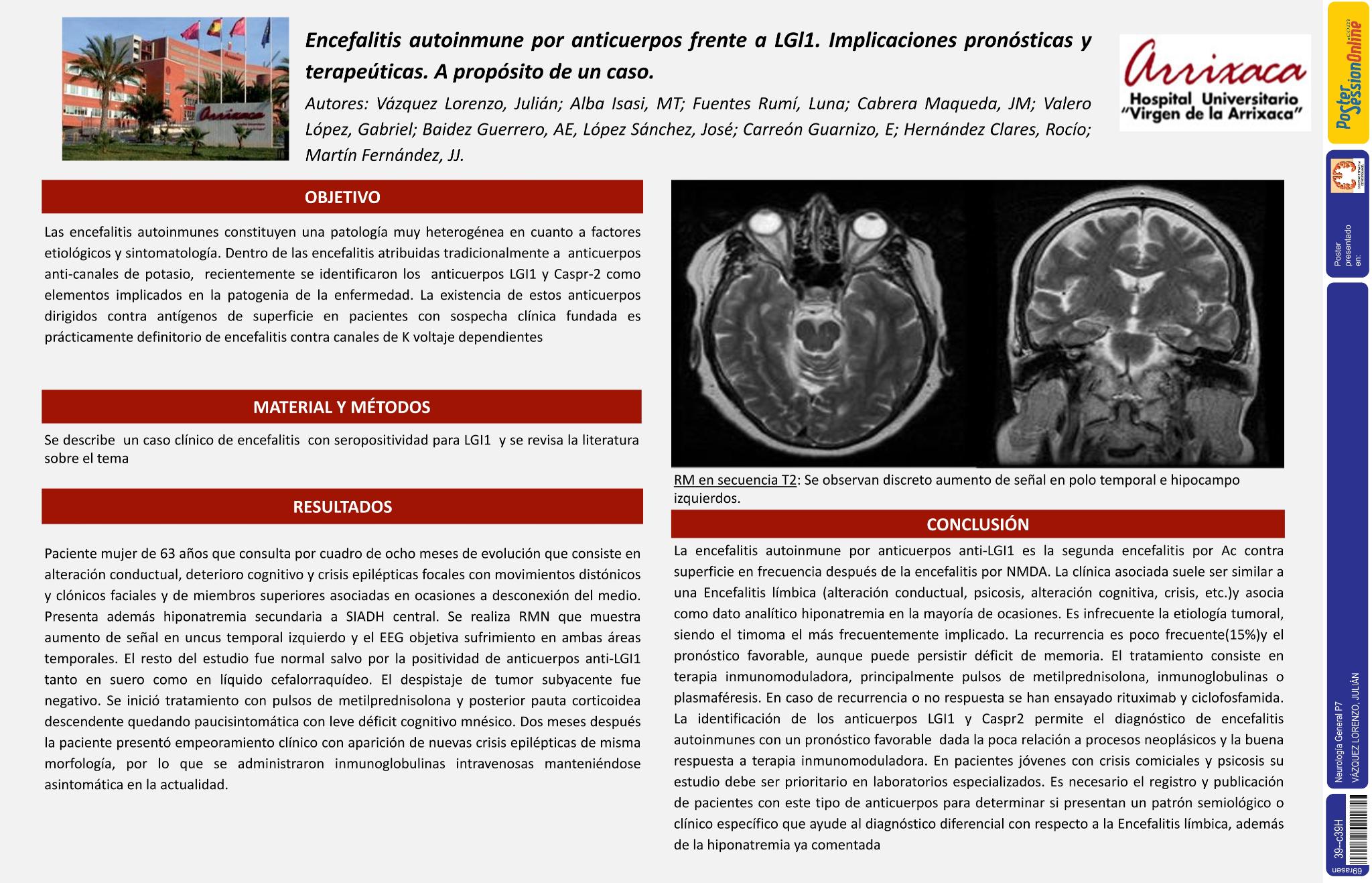 Encefalitis autoinmune por anticuerpos frente a LGl1. Implicaciones pronósticas y terapéuticas. A propósito de un caso
