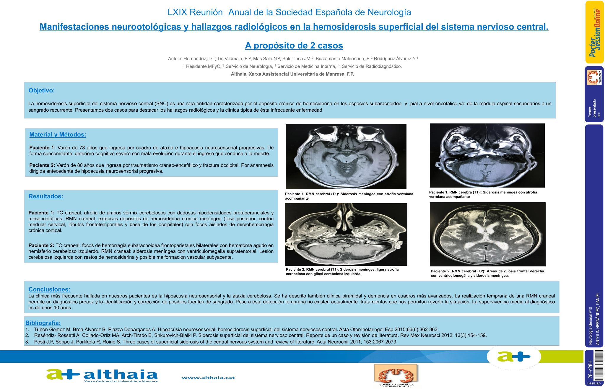 Manifestaciones neurootológicas y hallazgos radiológicos en la hemosiderosis superficial del sistema nervioso central: a propósito de 2 casos