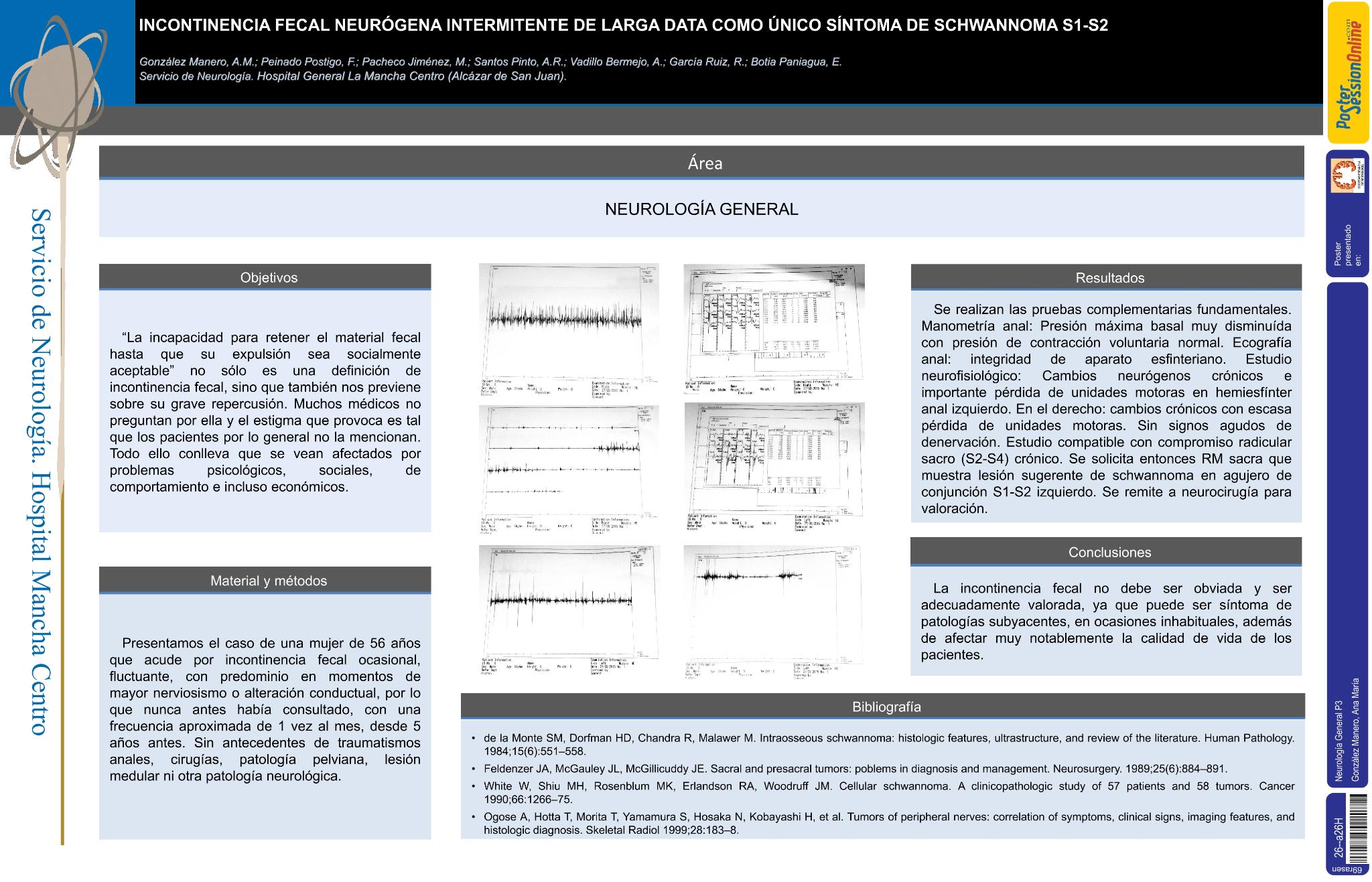 Incontinencia fecal neurógena intermitente de larga data como único síntoma de schwannoma S1-S2