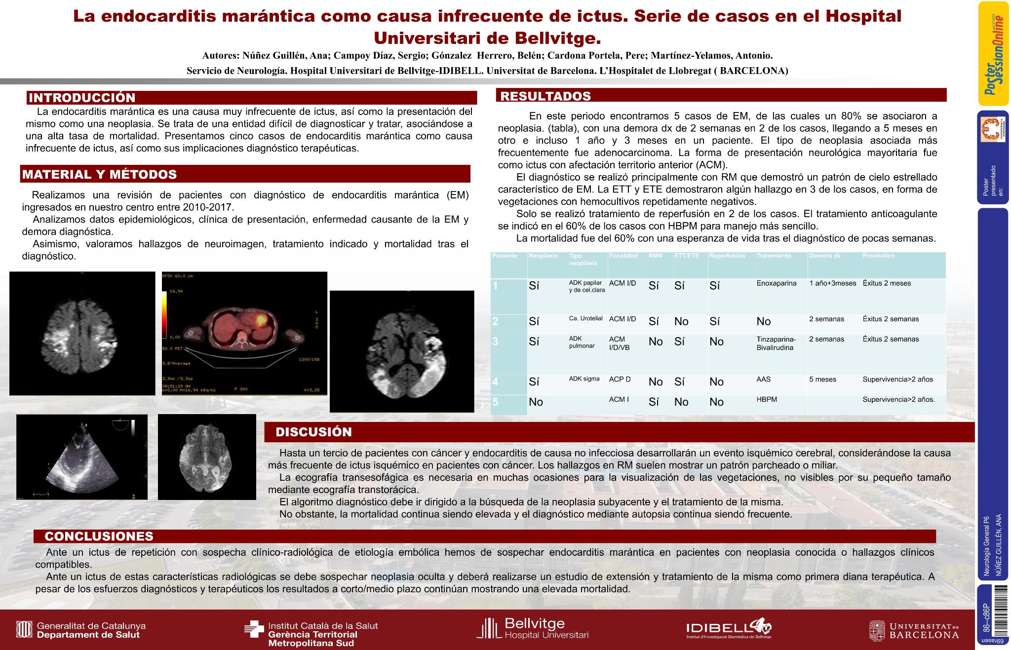 Endocarditis marántica como causa infrecuente de ictus. Serie de casos en el Hospital Universitario de Bellvitge