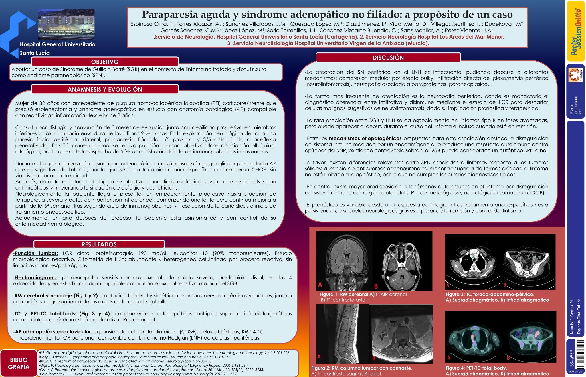 Paraparesia aguda y síndrome adenopático no filiado: a propósito de un caso