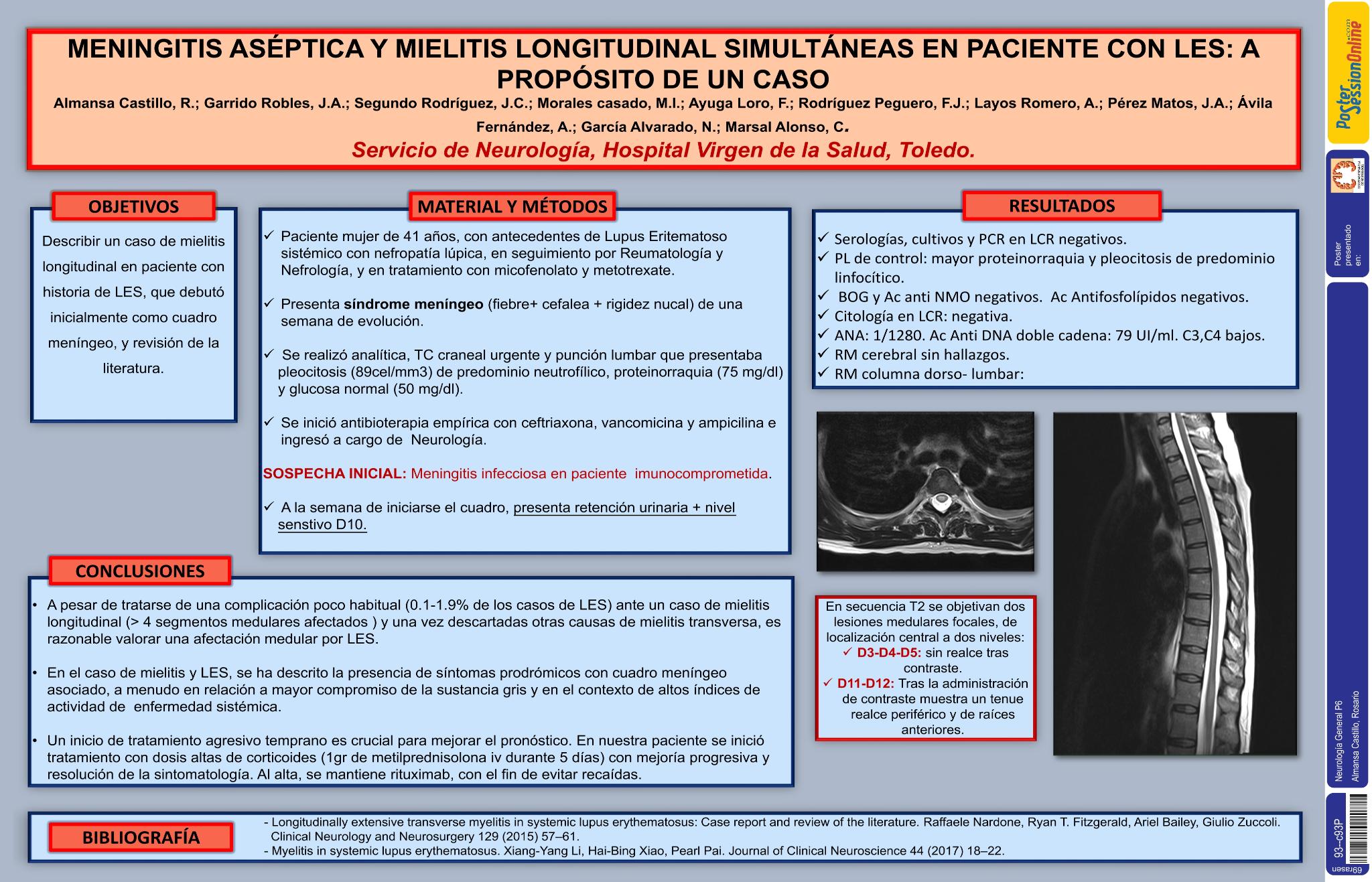 Meningitis aséptica y mielitis longitudinal simultáneas en paciente con LES: a propósito de un caso