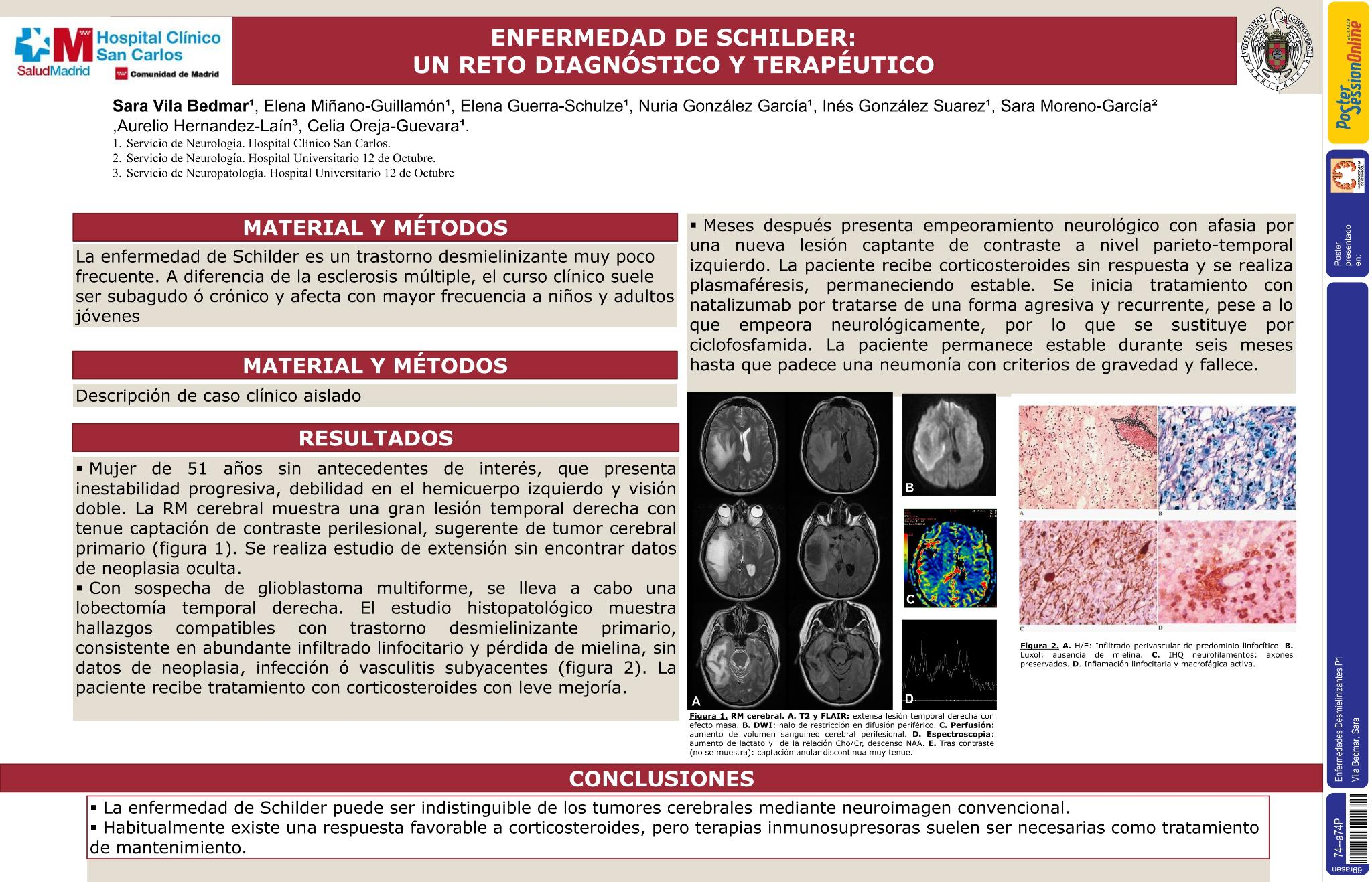 Enfermedad de Schilder: comportamiento pseudotumoral de un trastorno desmielinizante