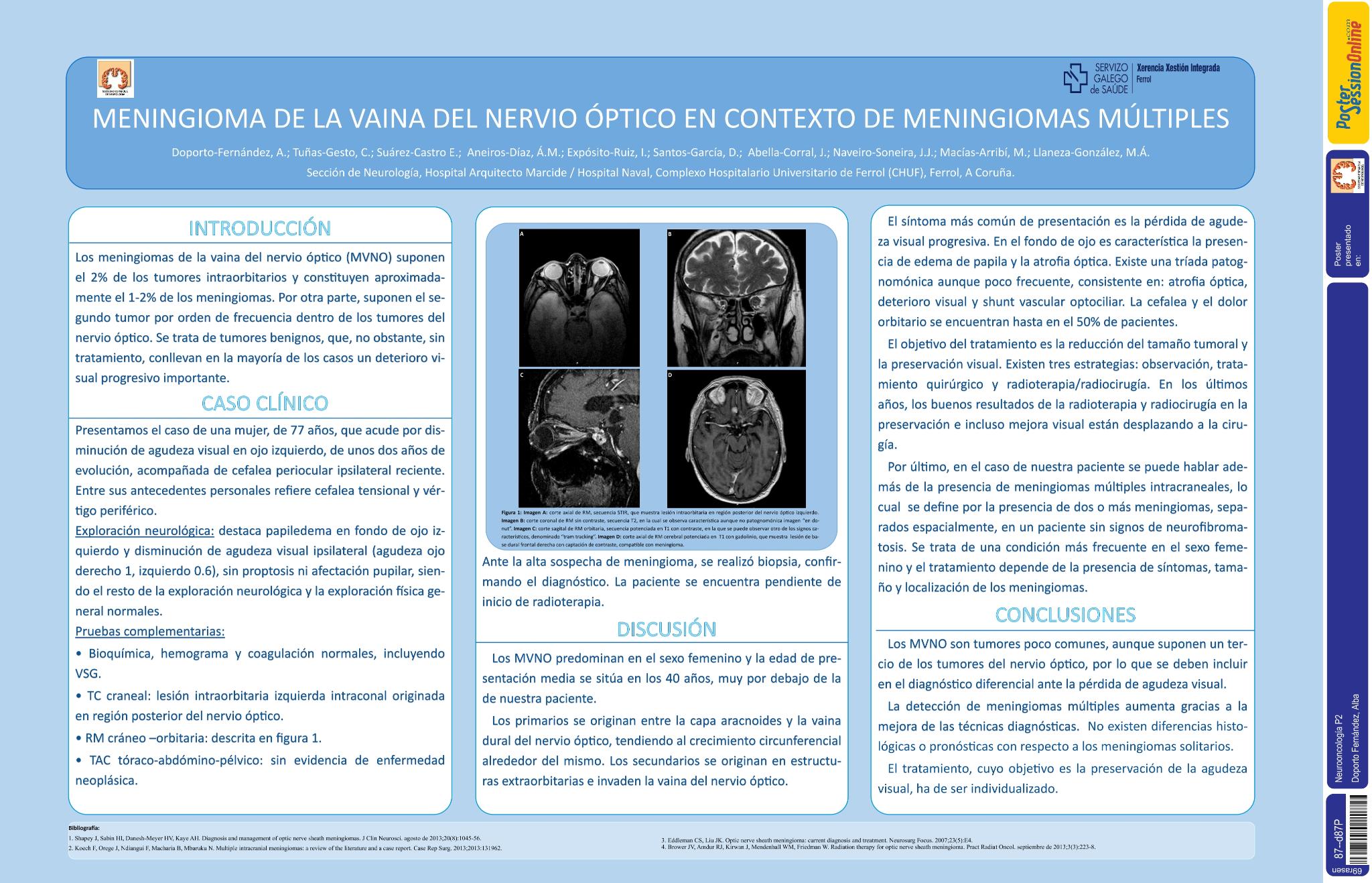 Meningioma de la vaina del nervio óptico en contexto de meningiomas múltiples