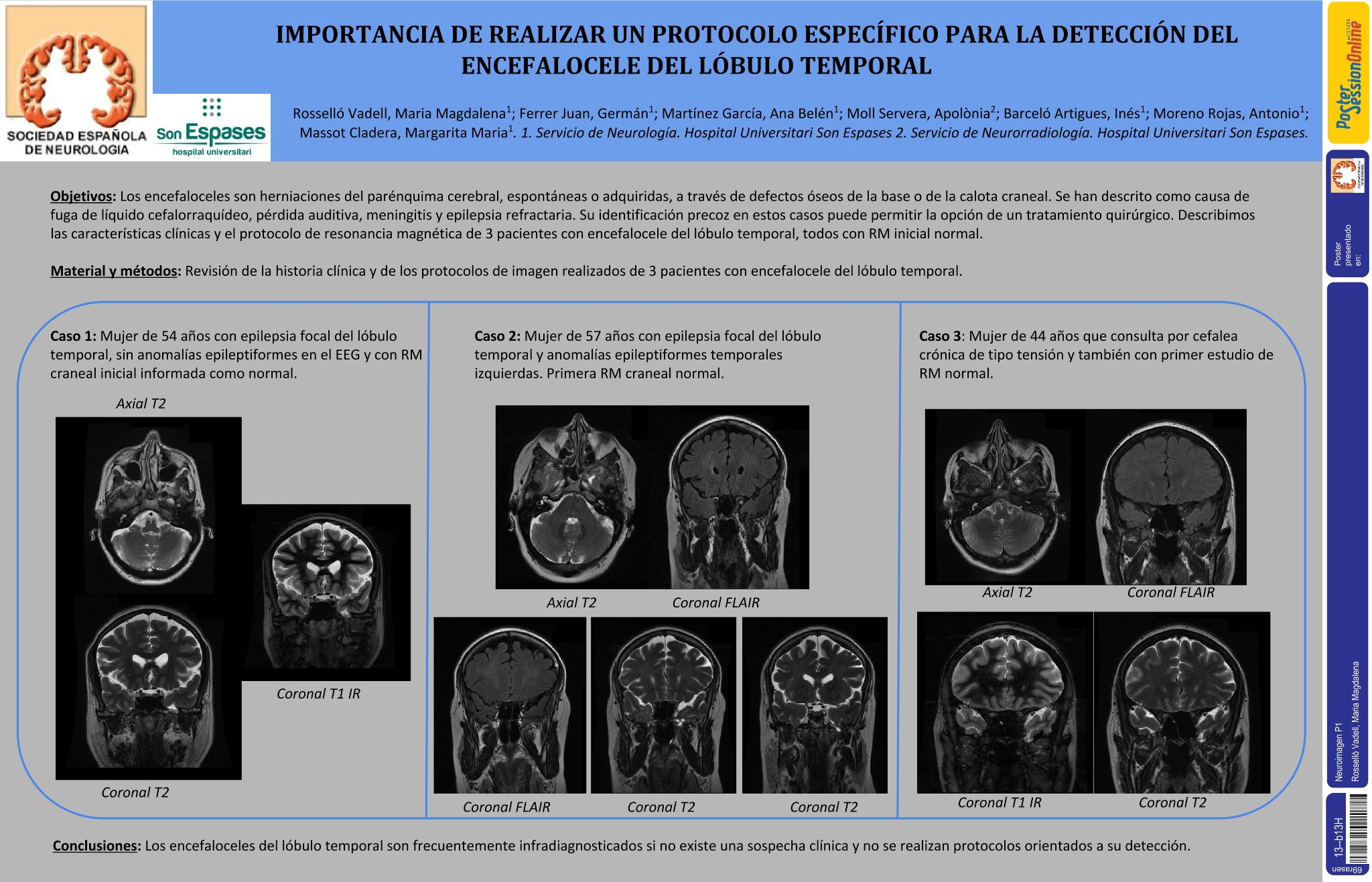 Importancia de realizar un protocolo específico para la detección del encefalocele del lóbulo temporal