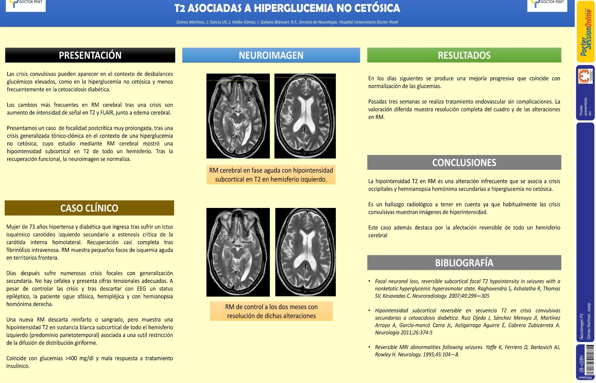 Déficit neurológico postcrítico prolongado e hipointensidad T2 asociadas a hiperglucemia no cetósica