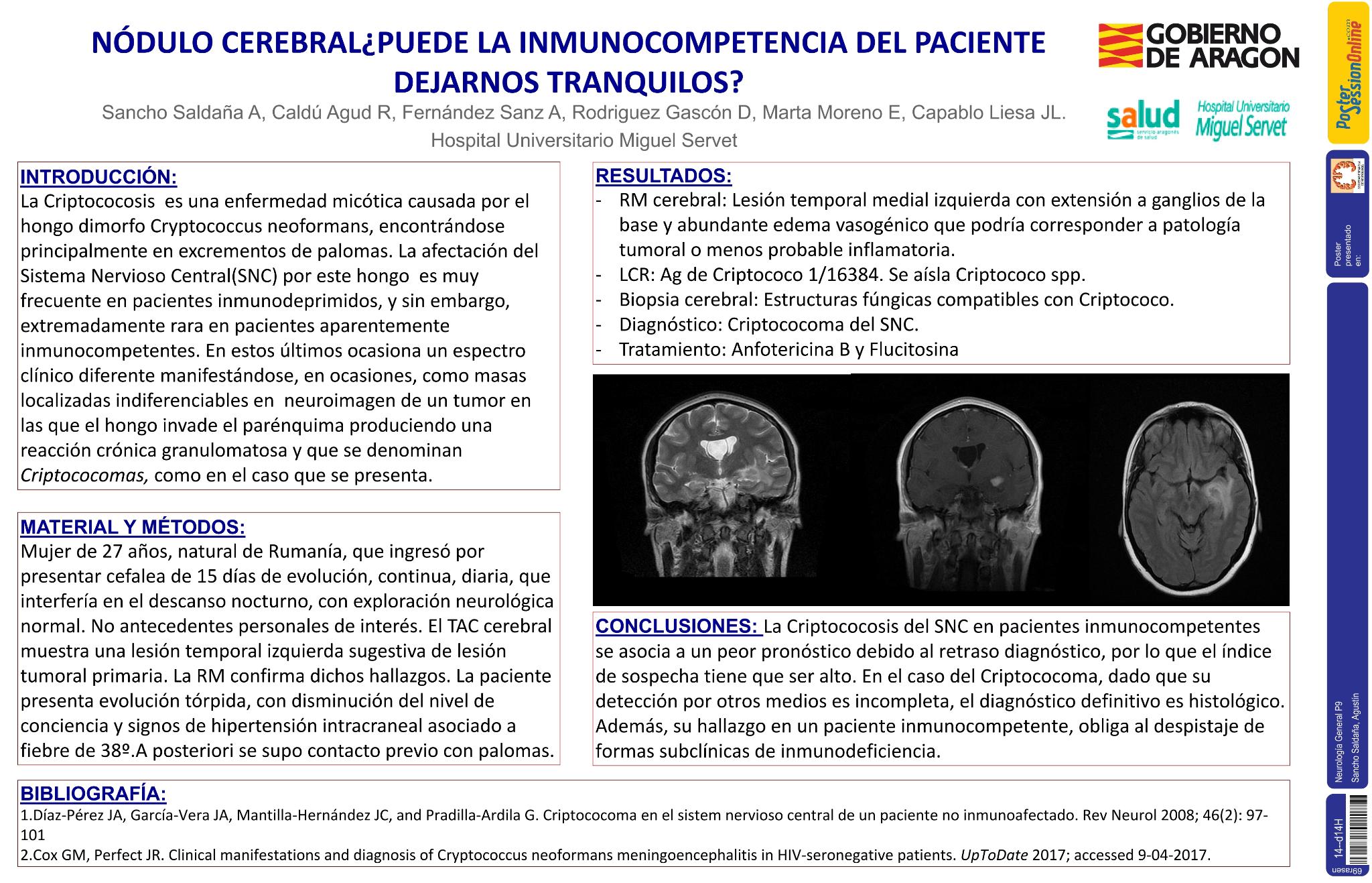 Nódulo cerebral: ¿puede la inmunocompetencia del paciente dejarnos tranquilos?