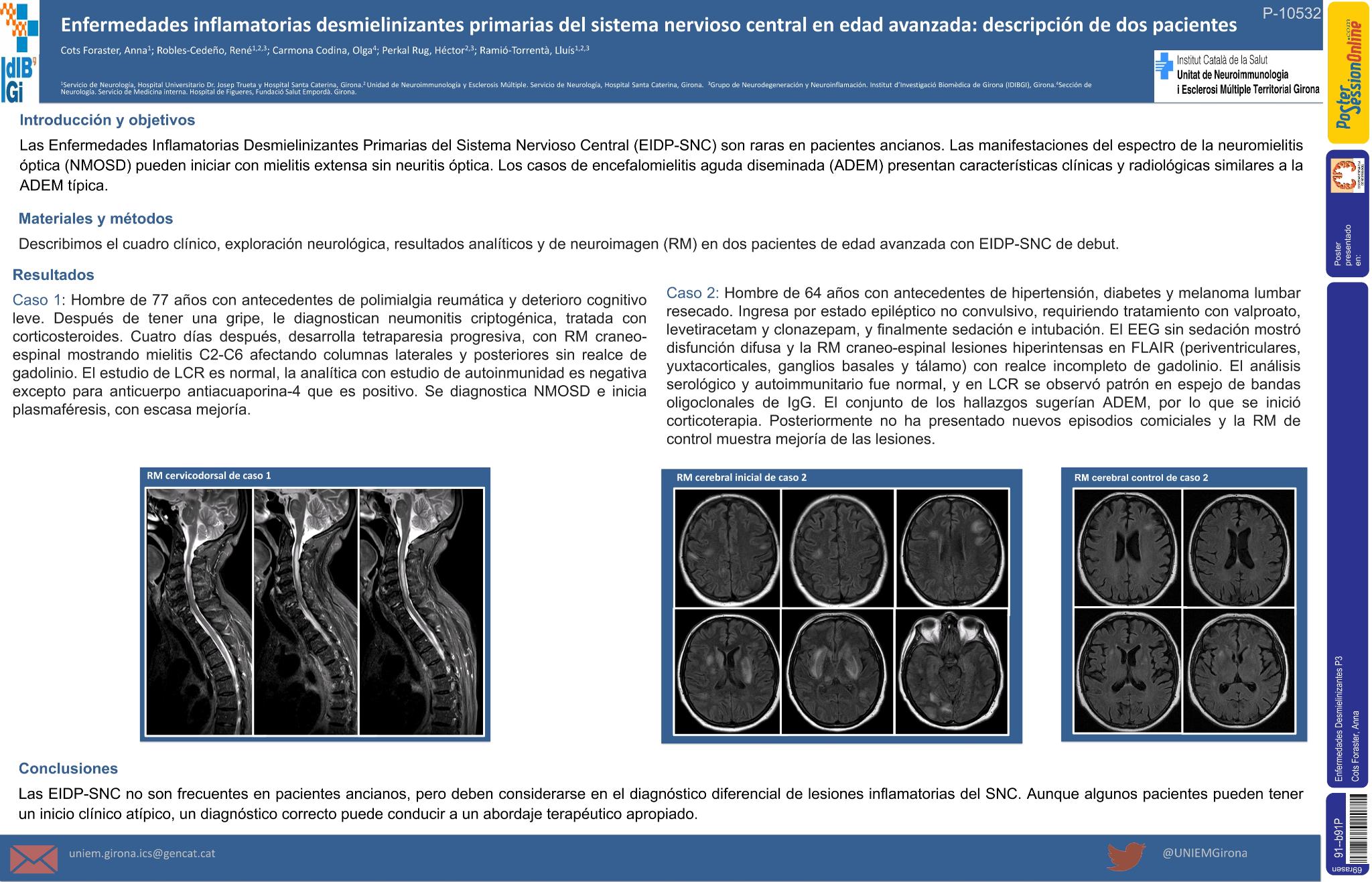 Enfermedades desmielinizantes inflamatorias primarias del sistema nervioso central en edad avanzada: descripción de dos pacientes