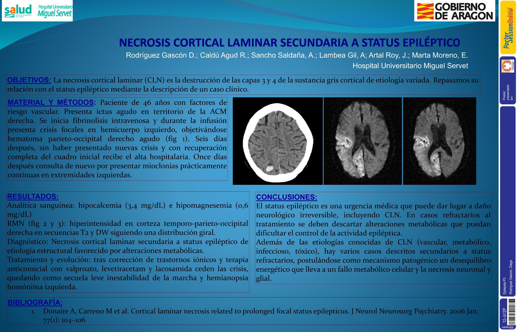 Necrosis cortical laminar secundaria a estatus epiléptico