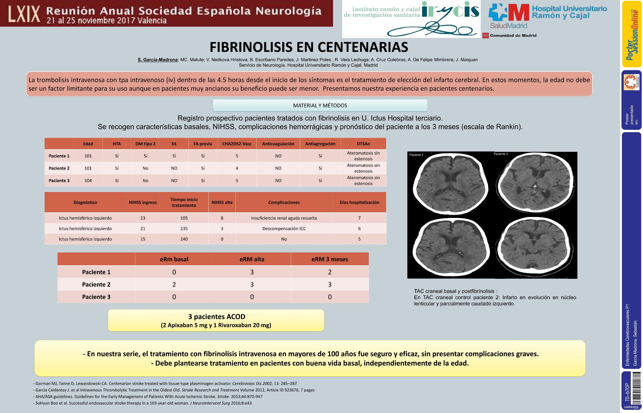 Fibrinolisis en centenarias