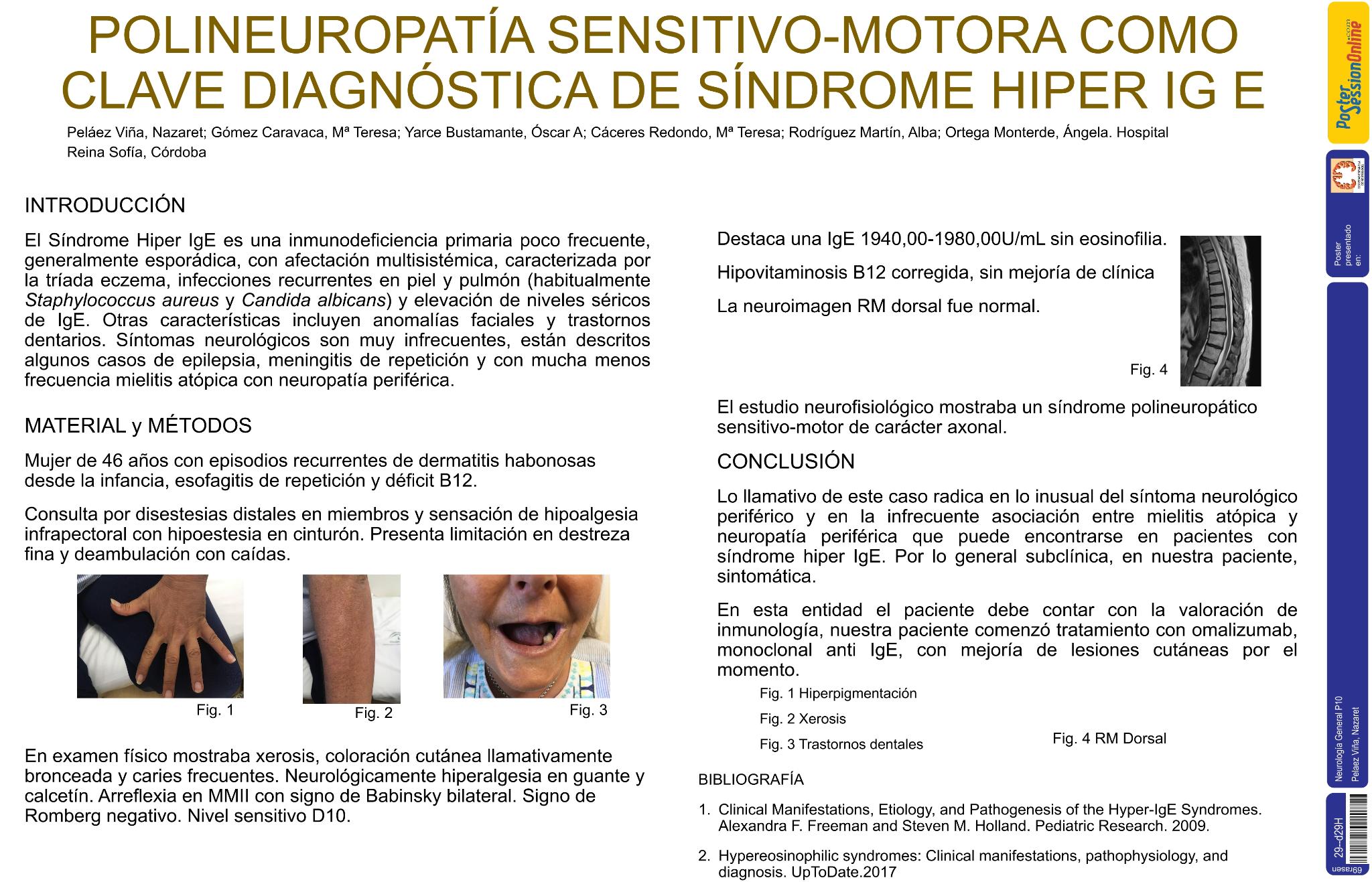 Polineuropatía como clave diagnóstica de un síndrome Hiper-IgE