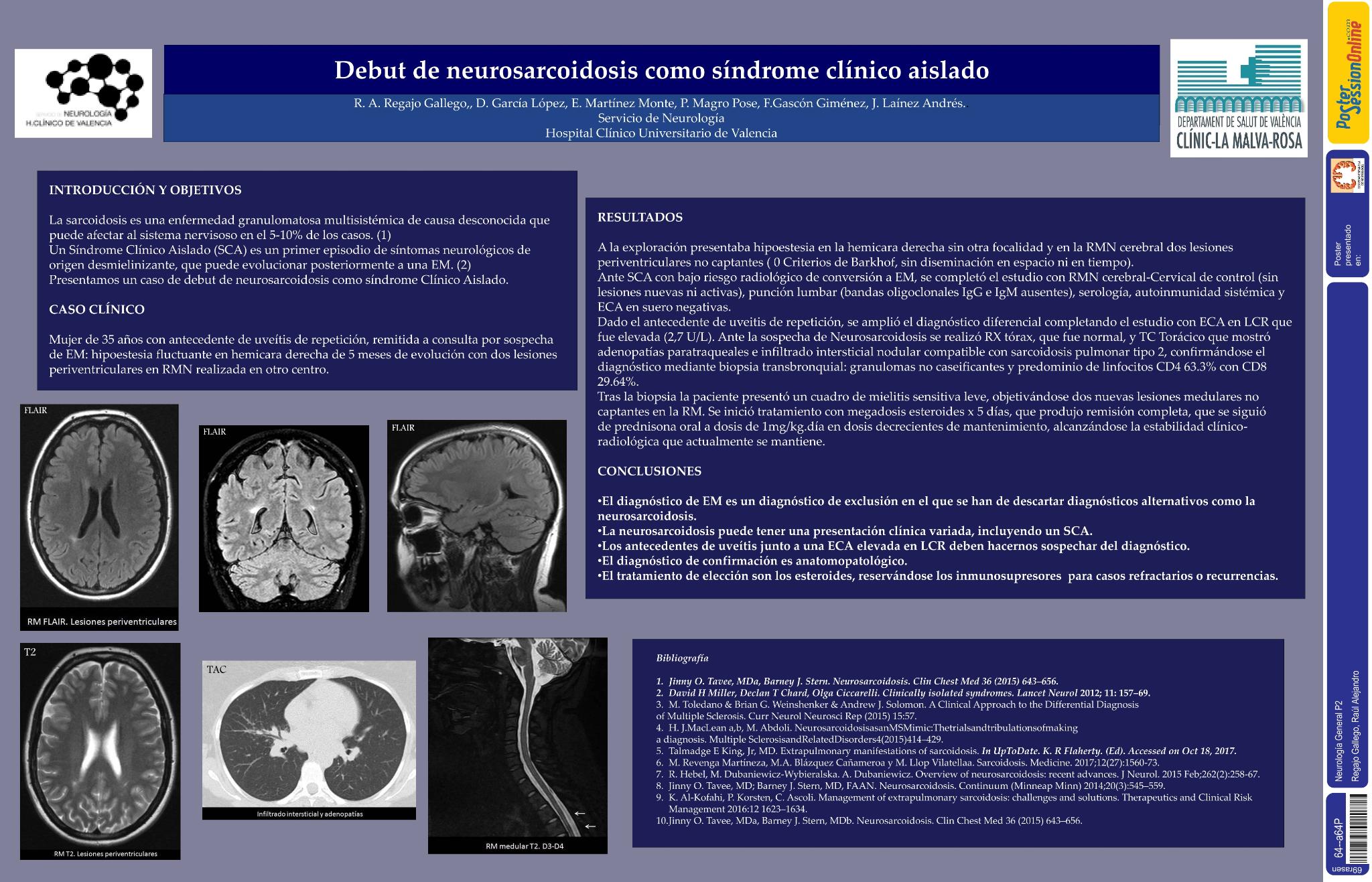Debut de neurosarcoidosis como síndrome clínico aislado