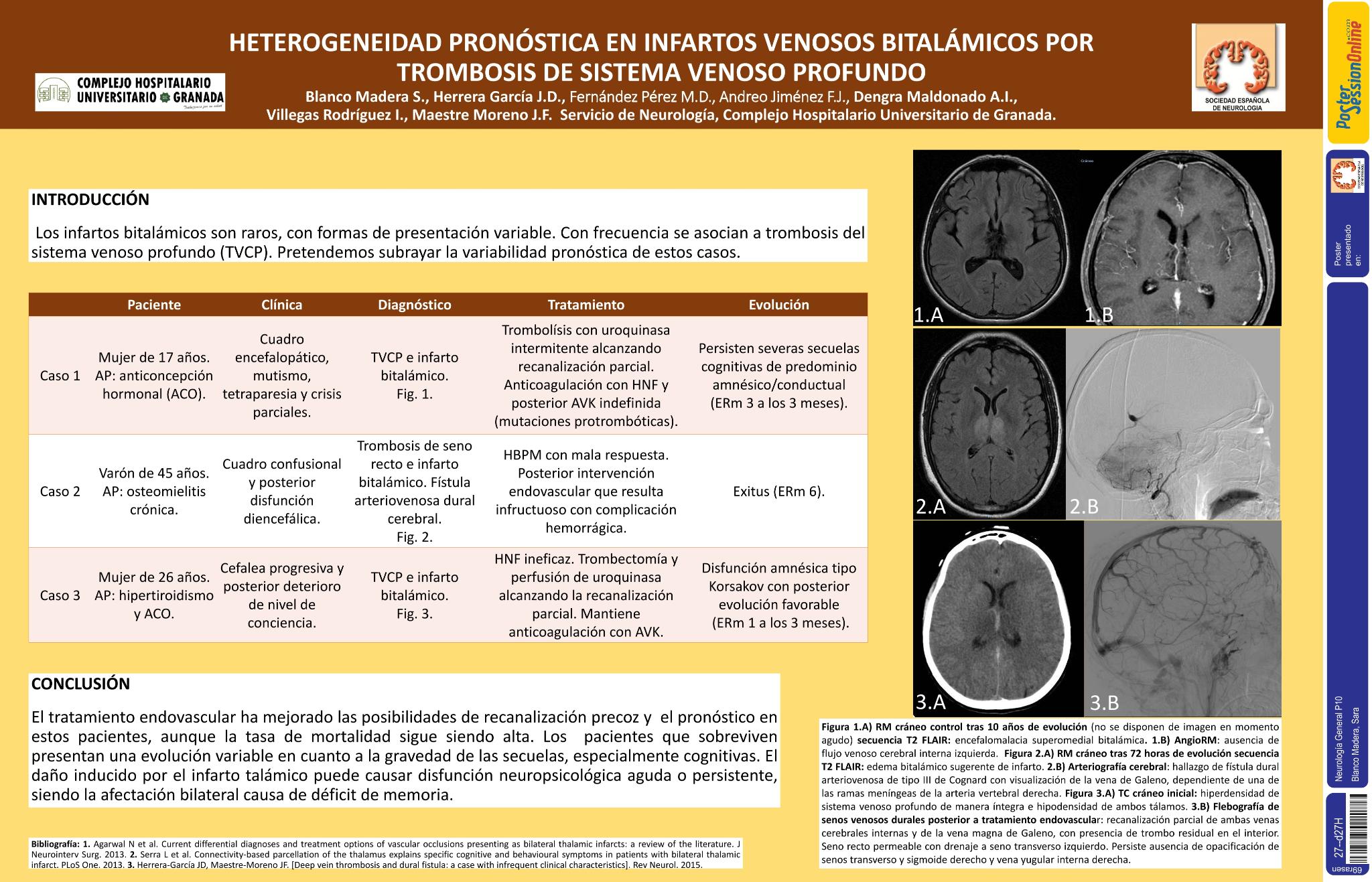 Heterogeneidad pronóstica en infartos venosos bitalámicos por trombosis de sistema venoso profundo