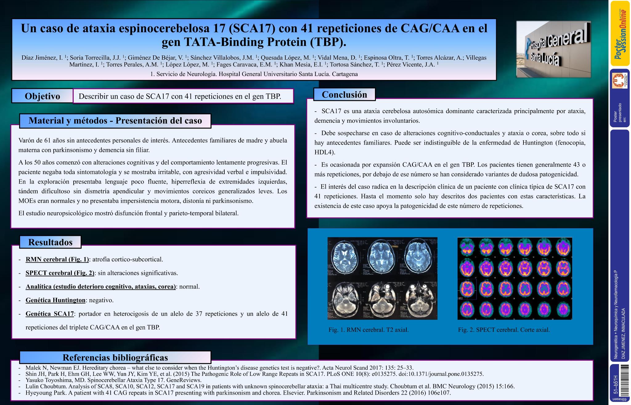 Un caso de ataxia espinocerebelosa 17 (SCA17) con 41 repeticiones de CAG/CAA en el gen TATA-Binding Protein (TBP)