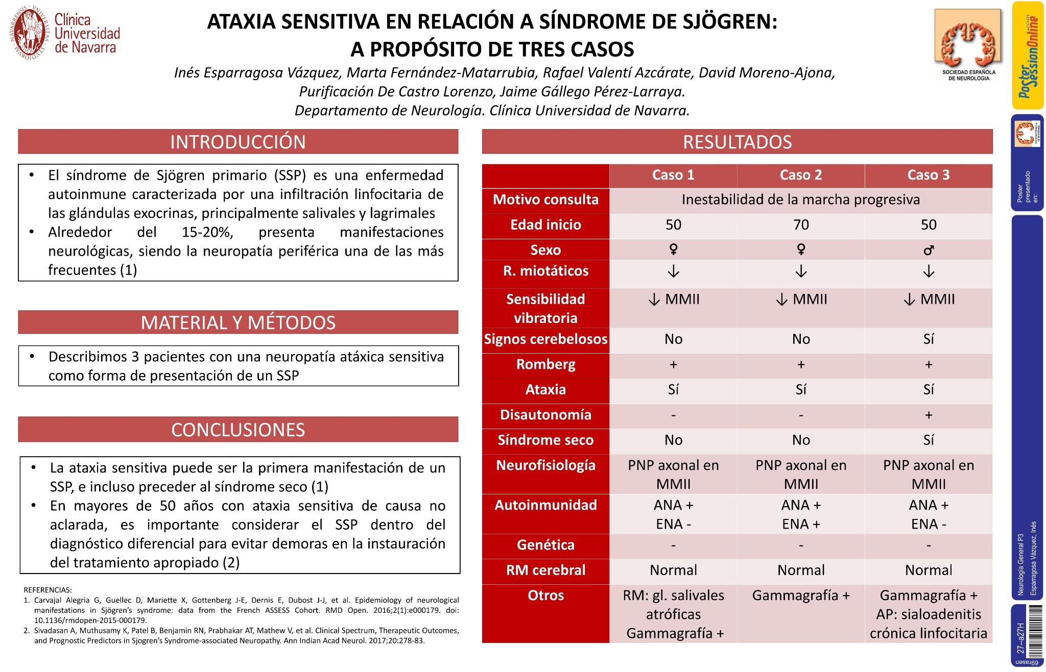 Ataxia sensitiva en relación a síndrome de Sjögren: a propósito de tres casos