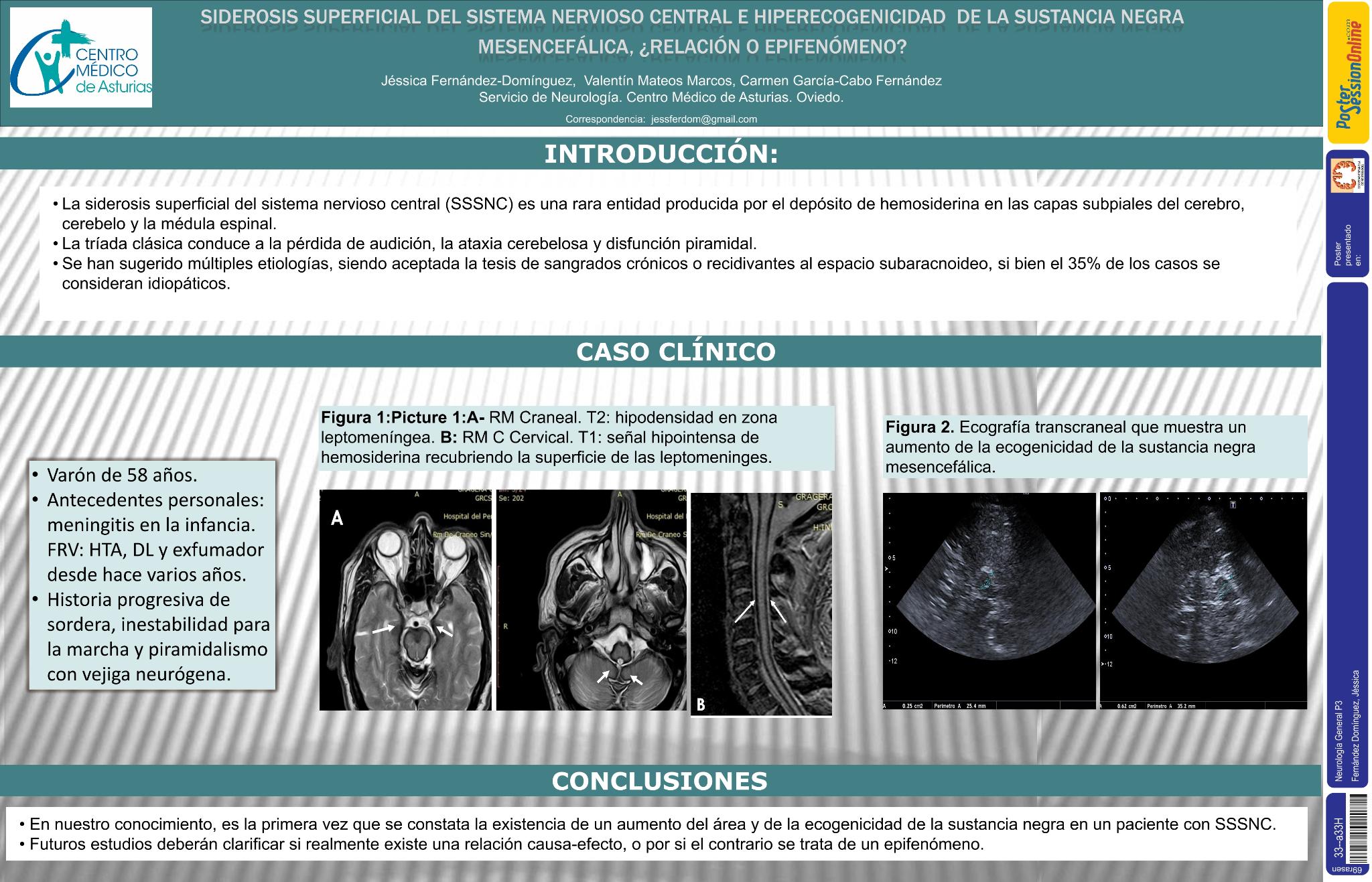 Siderosis superficial del sistema nervioso central e hiperecogenicidad de la sustancia negra mesencefálica, ¿relación o epifenómeno?