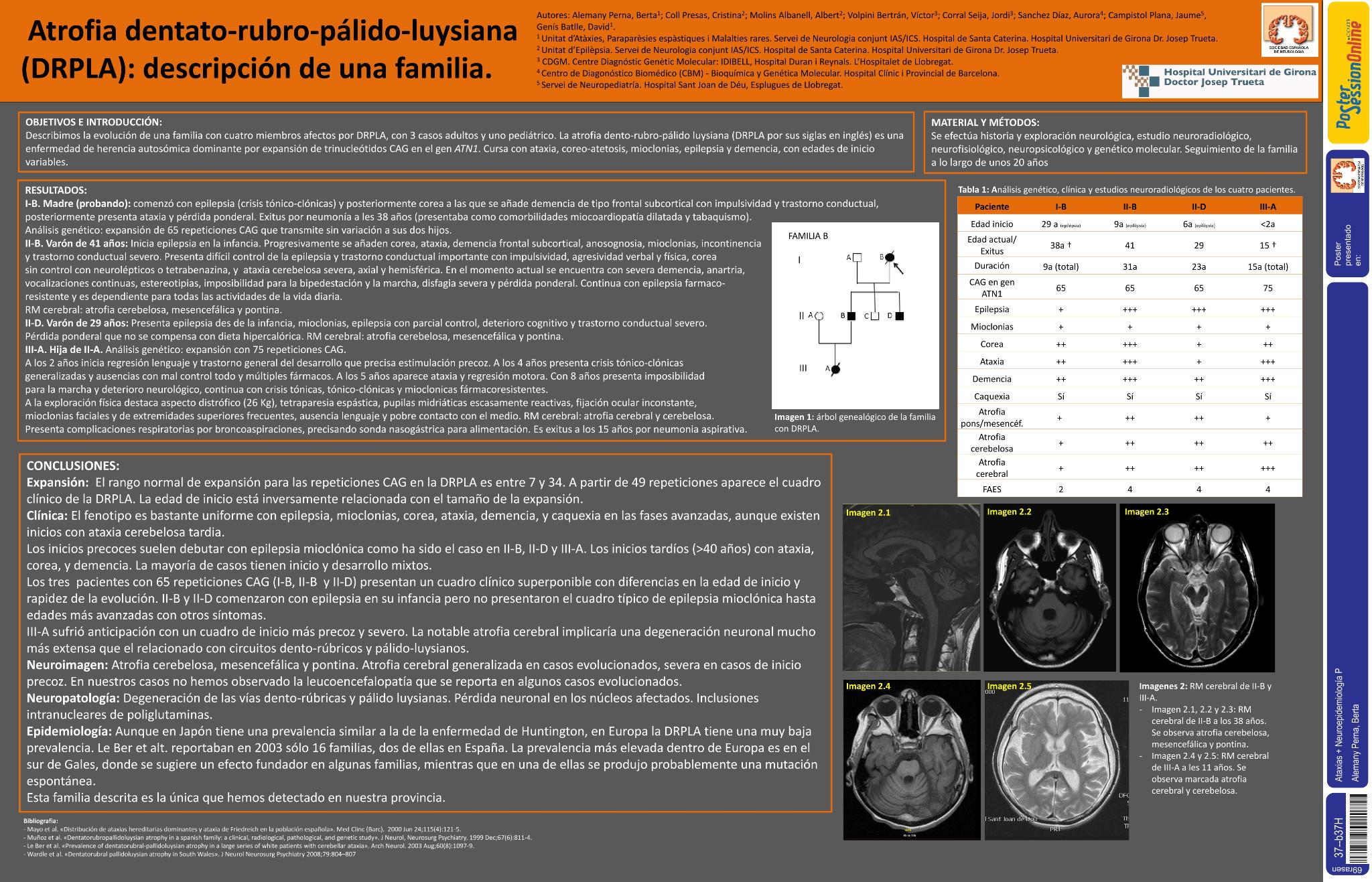 Atrofia dentato-rubro-pálido-luisiana (DRPLA): descripción de una familia