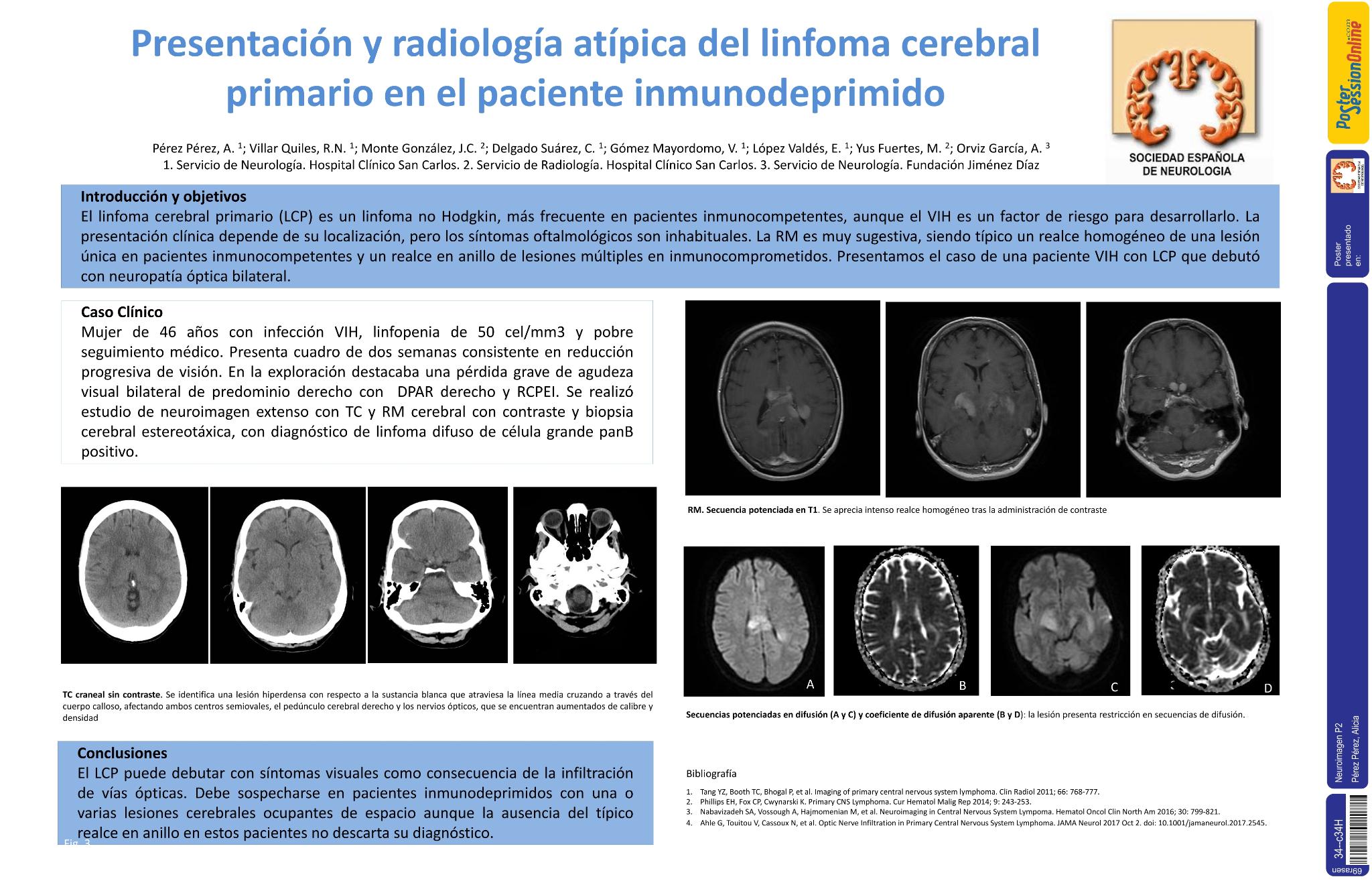 Presentación y radiología atípica del linfoma cerebral primario en el paciente inmunodeprimido