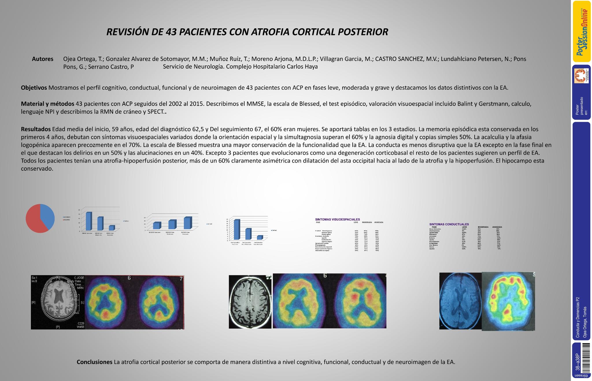Revisión de 43 pacientes con atrofia cortical posterior