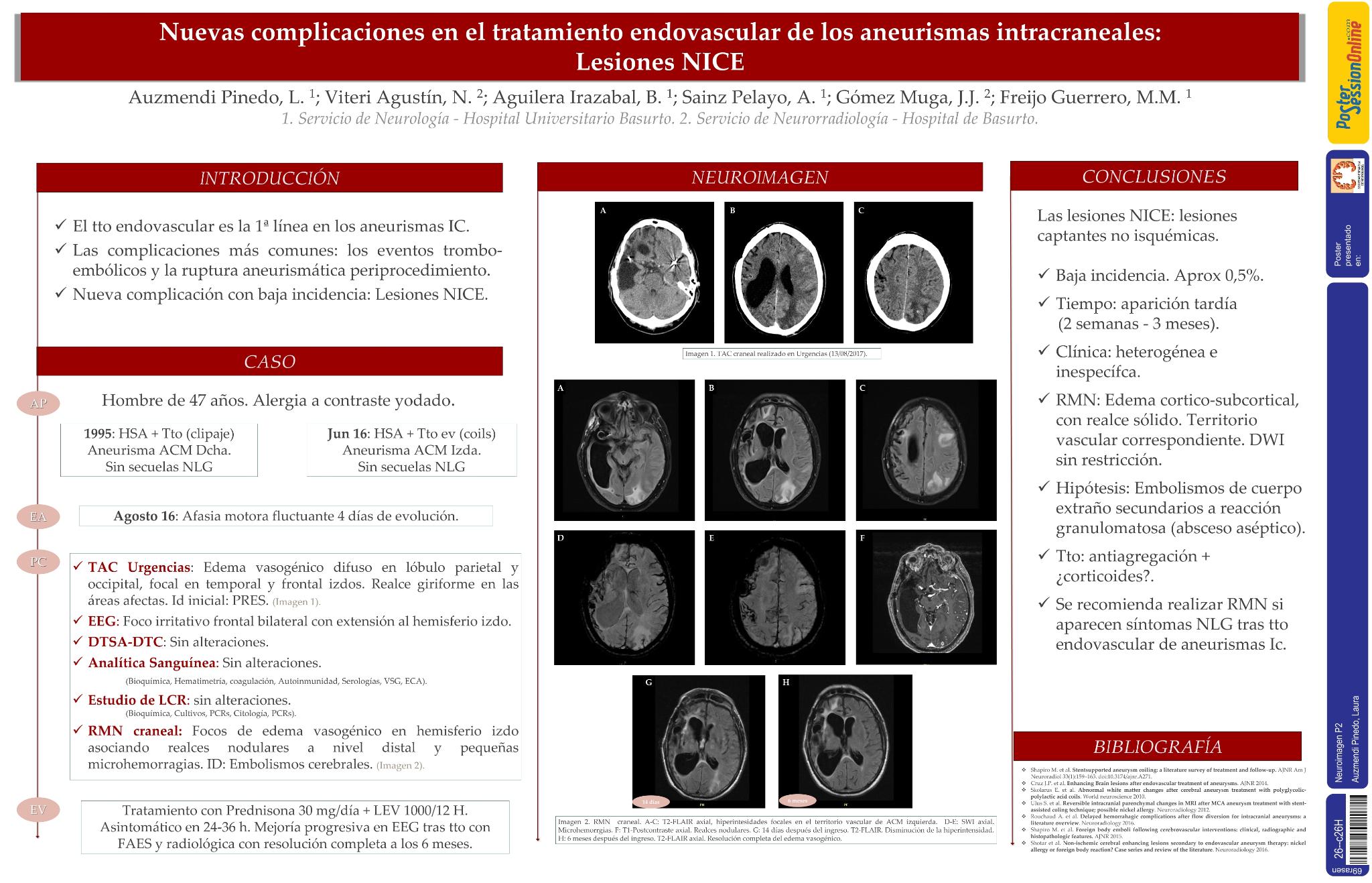Nuevas complicaciones en el tratamiento endovasculares de aneurimas intracraneales: lesiones NICE