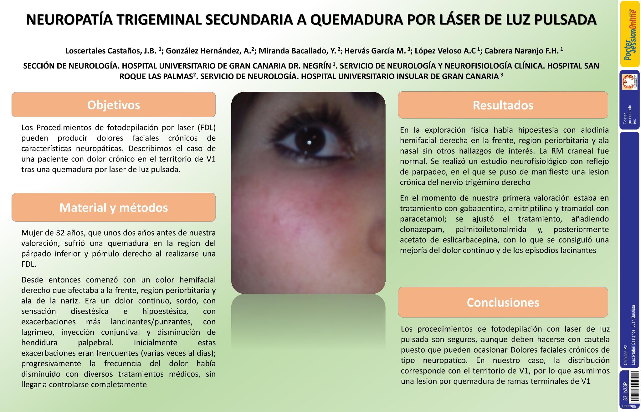 Neuropatía trigmeminal secundaria a quemadura por láser de luz pulsada