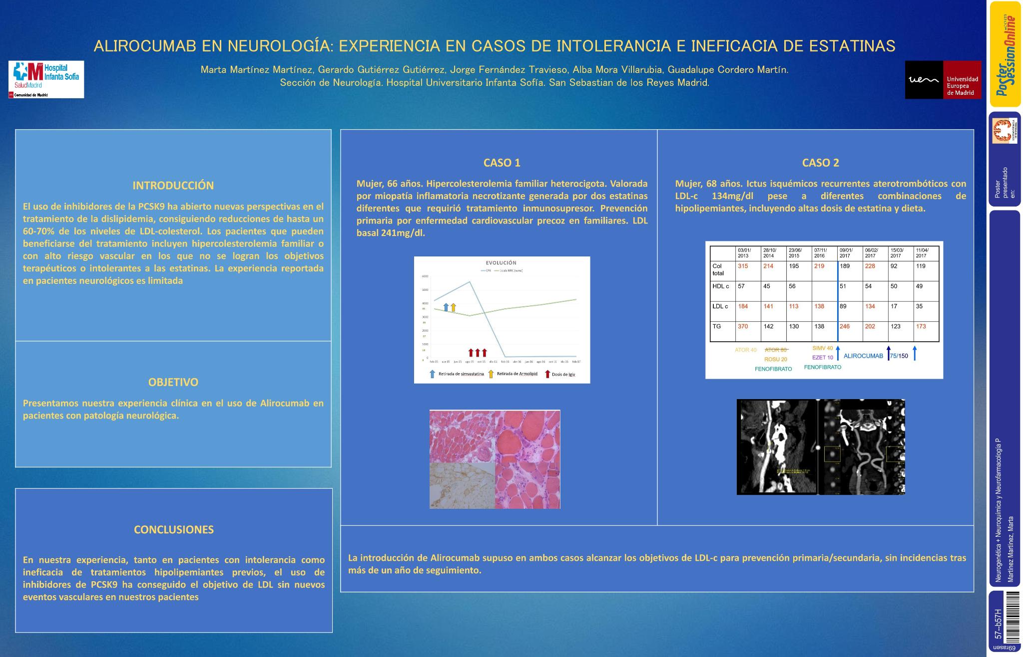 Alirocumab en neurología: experiencia en casos de intolerancia e ineficacia de estatinas
