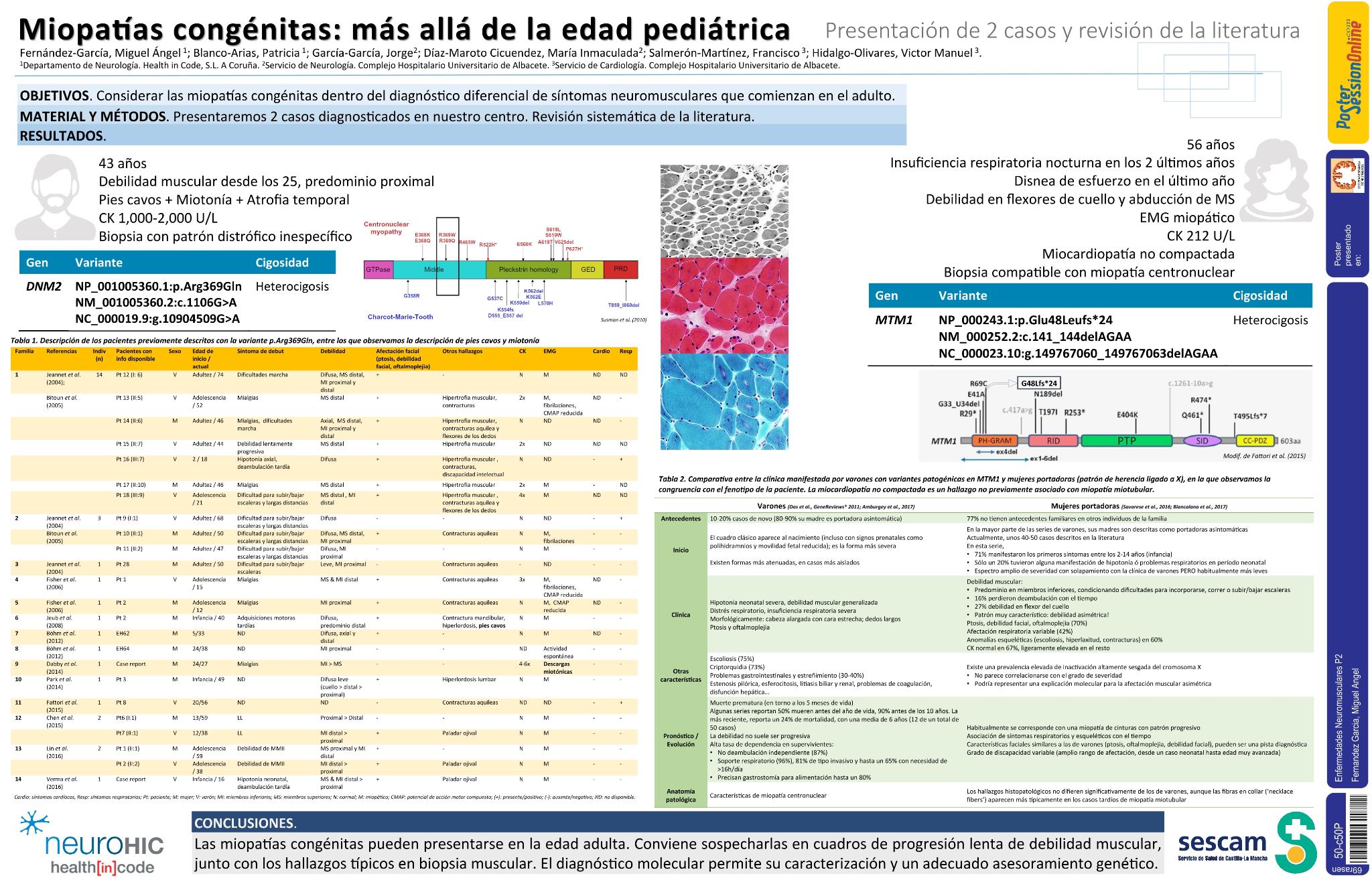 Miopatías congénitas: más allá de la edad pediátrica. Presentación de 2 casos y revisión de la literatura