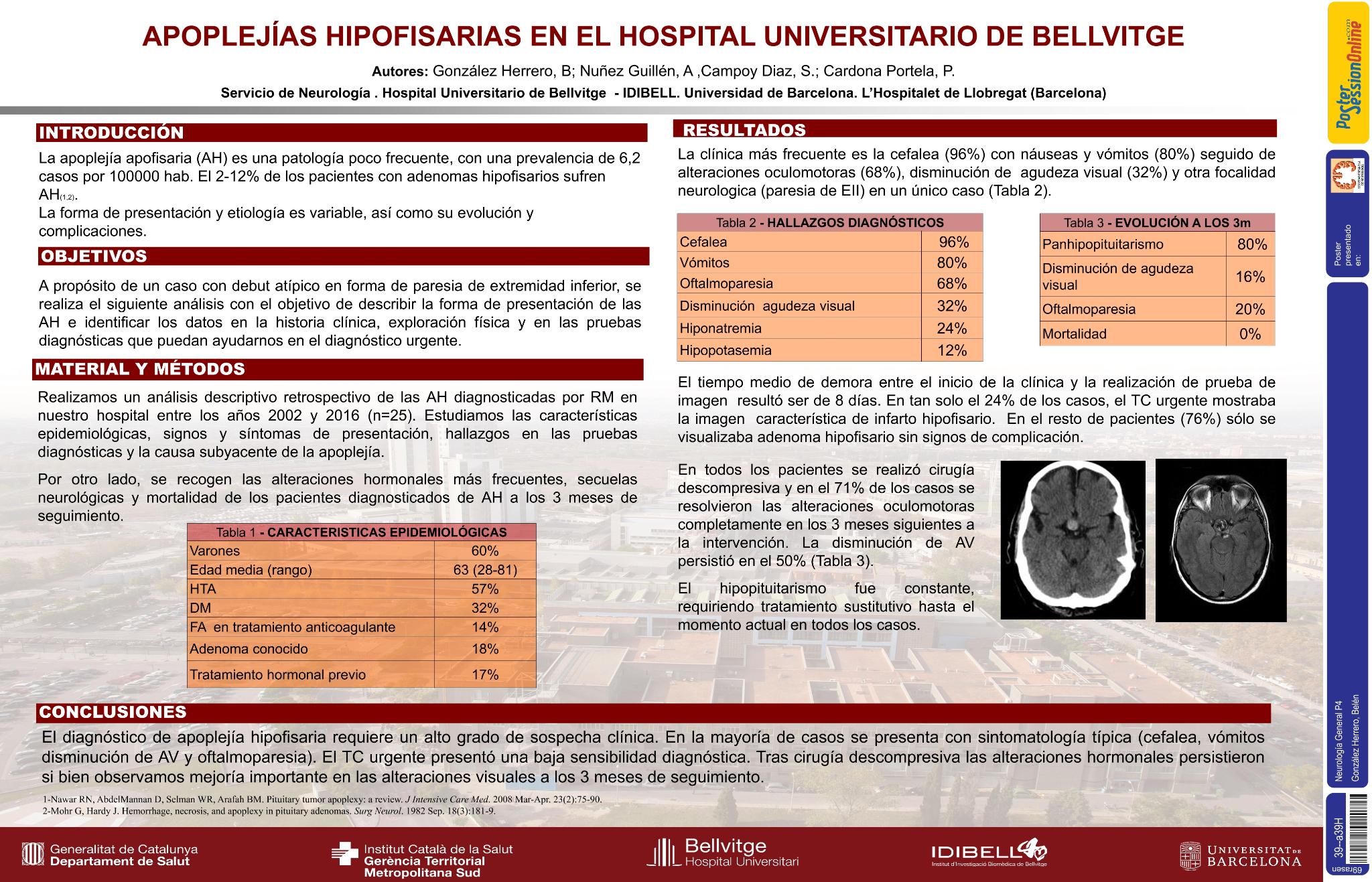 La apoplejía hipofisaria, un diagnóstico a considerar en neurología