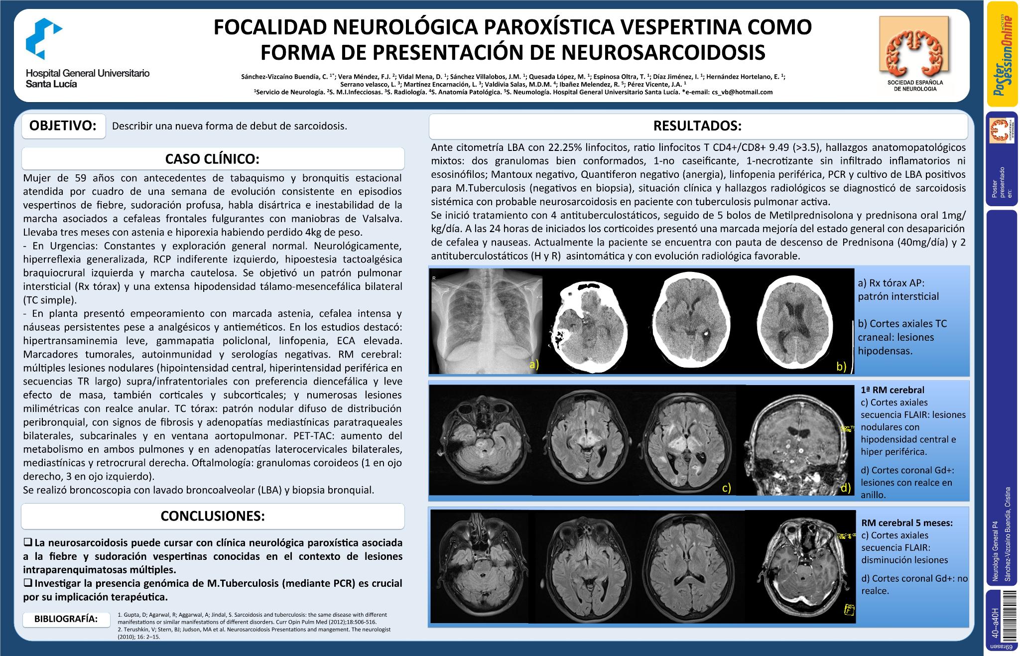 Focalidad neurológica paroxística vespertina como forma de presentación de neurosarcoidosis