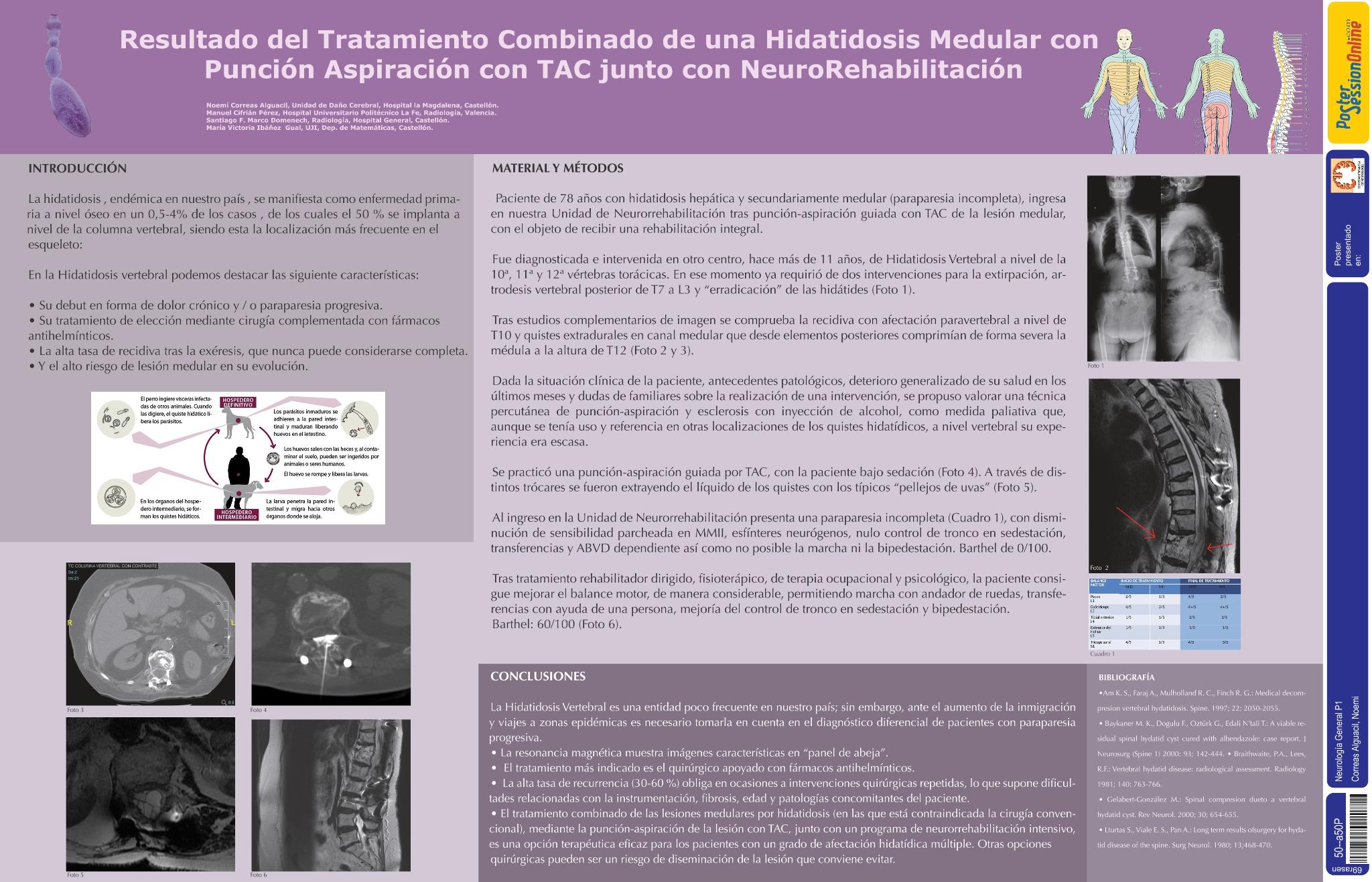 Resultado del tratamiento combinado de una hidatidosis medular con punción aspiración con TAC junto con neurorehabilitación