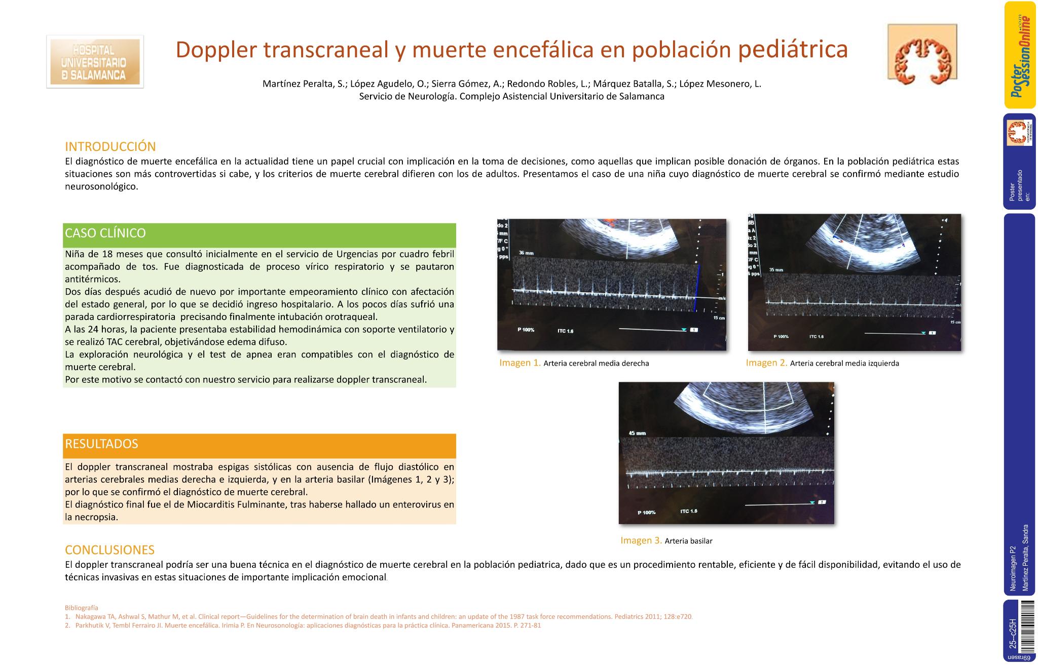 Doppler transcraneal y muerte encefálica en población pediátrica