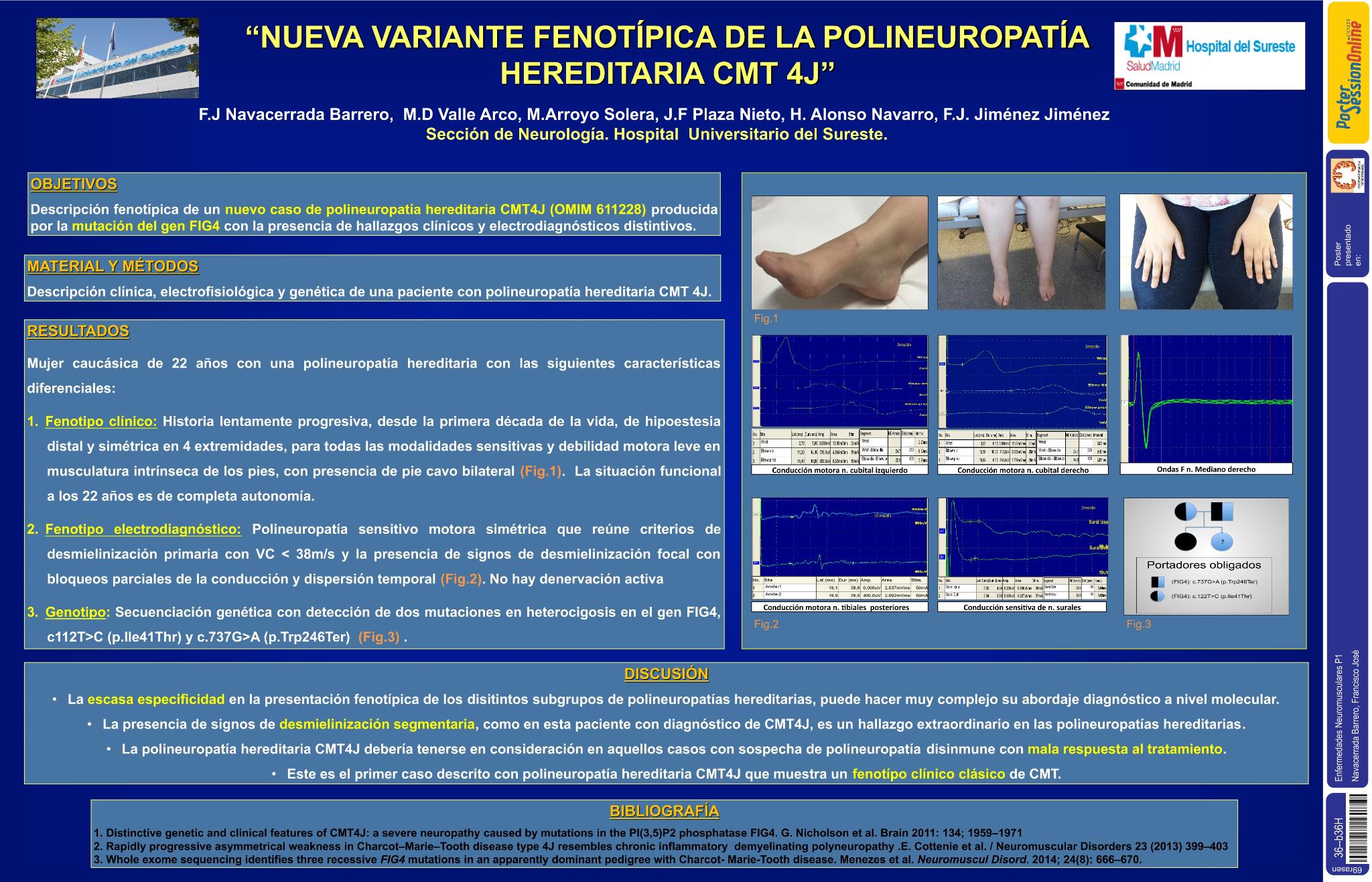 Nueva variante fenotípica de la polineuropatía hereditaria CMT4J