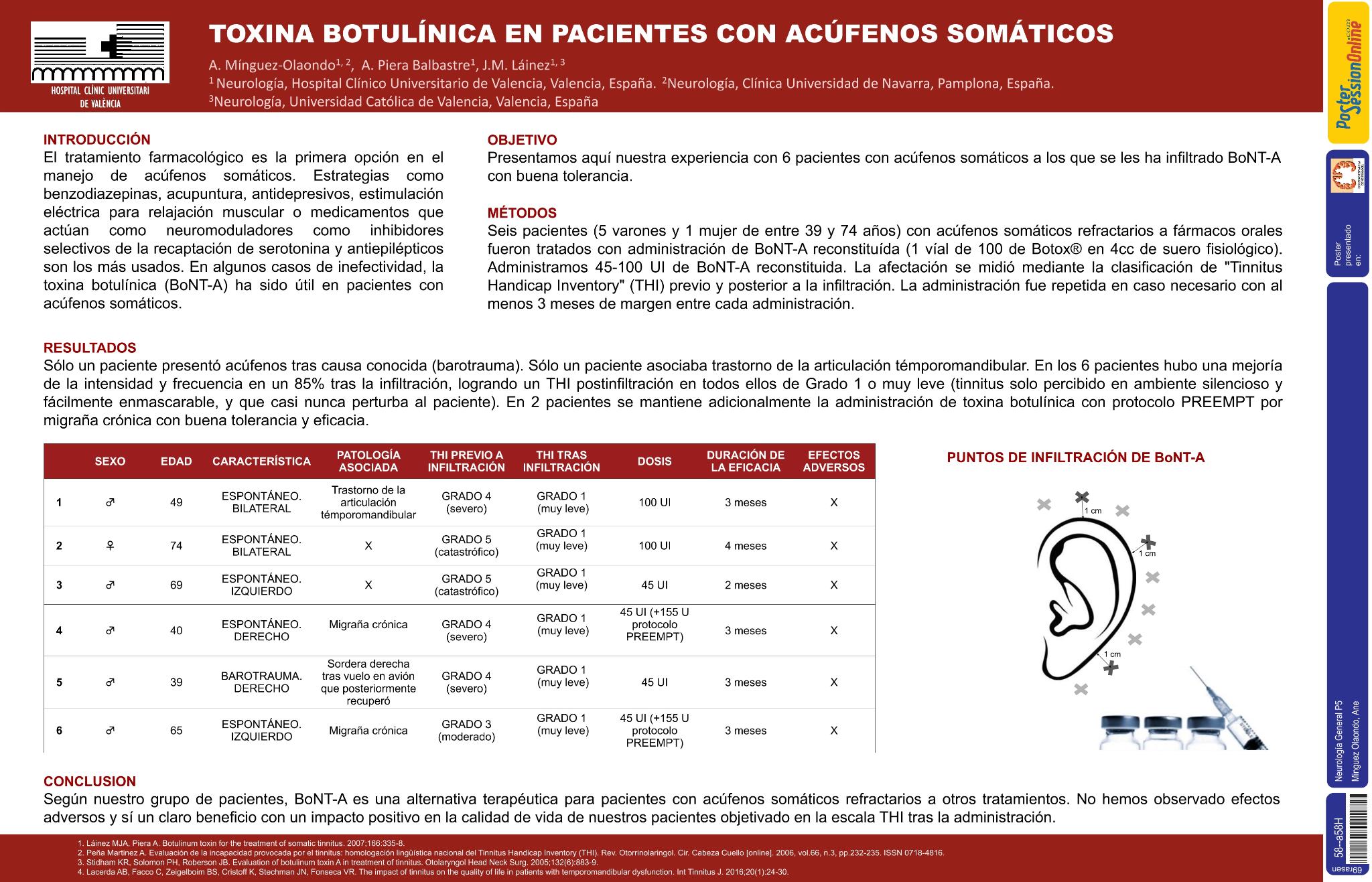 Toxina botulínica en pacientes con acúfenos somáticos