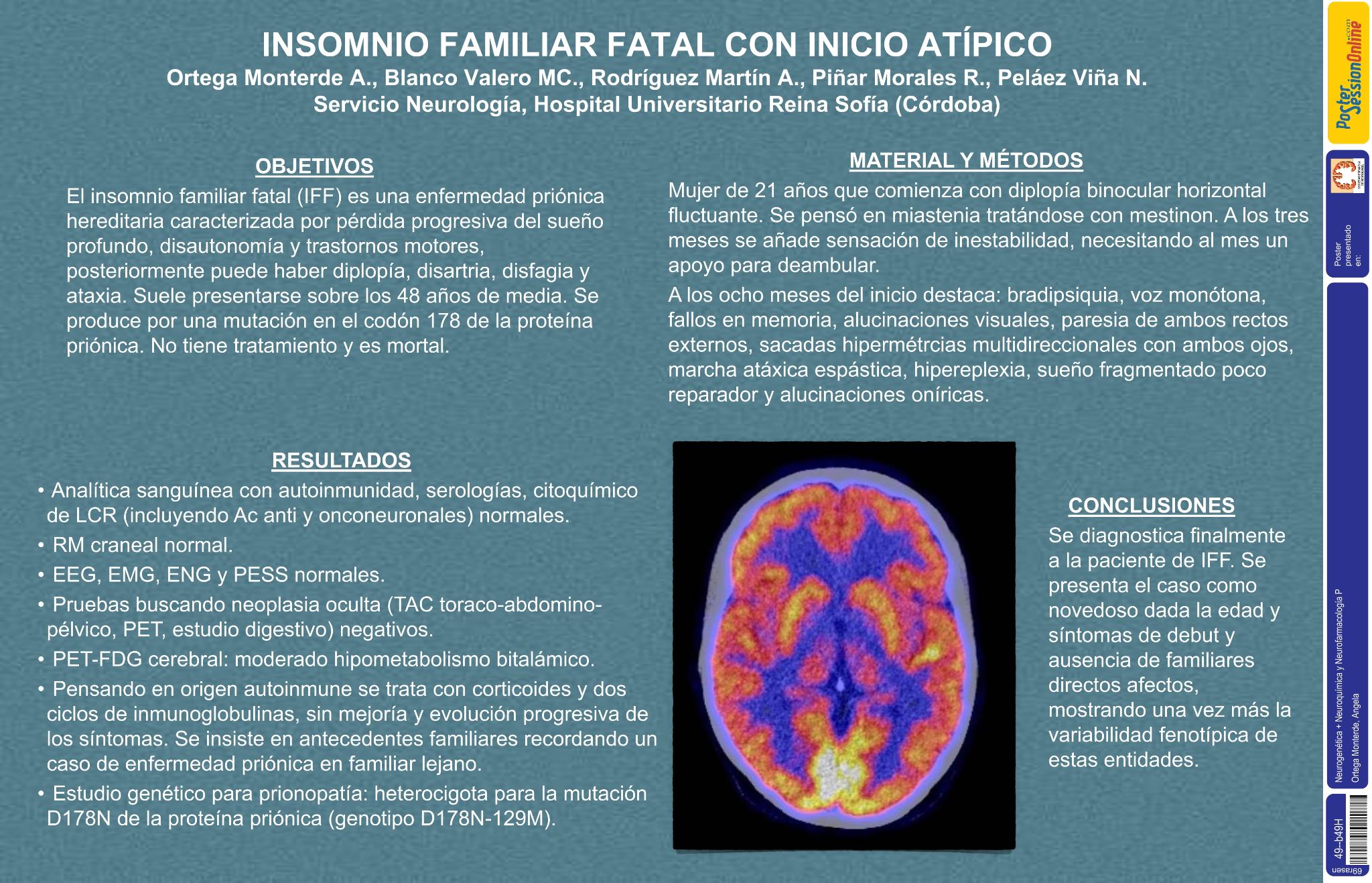 Insomnio familiar fatal con inicio atípico