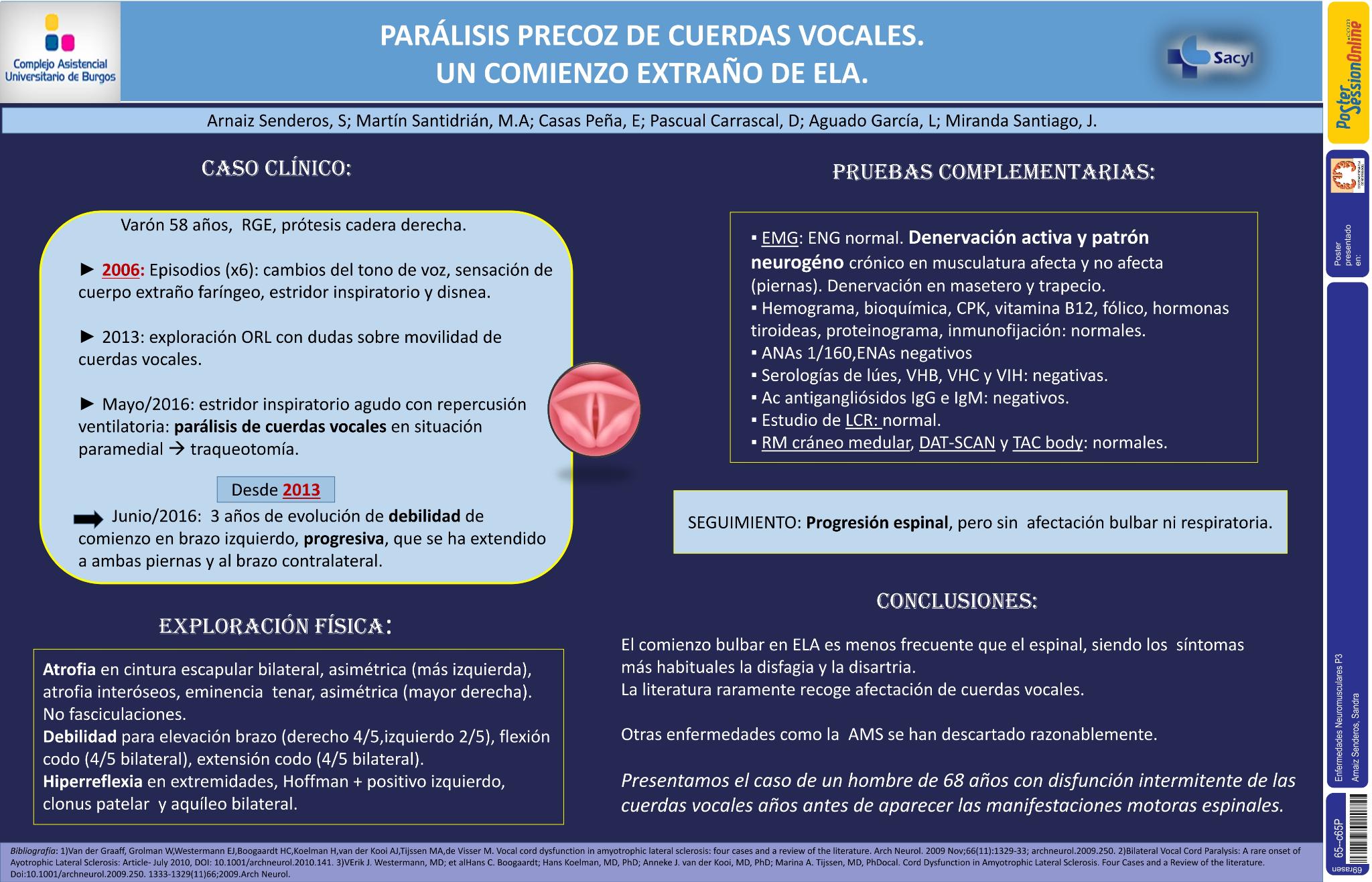 Parálisis precoz de cuerdas vocales. Un comienzo extraño de ELA