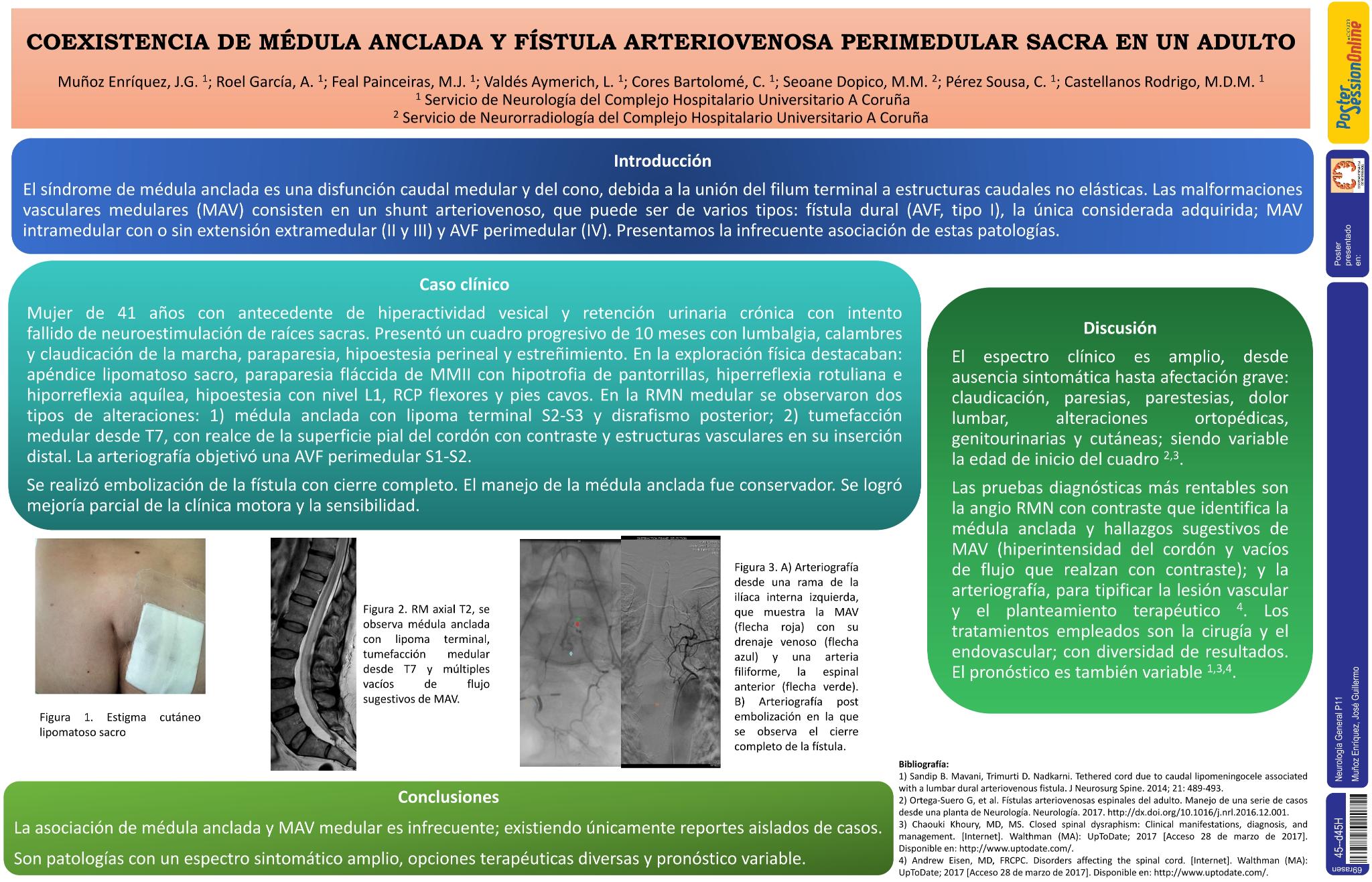 Coexistencia de médula anclada y fístula arteriovenosa perimedular sacra en un adulto
