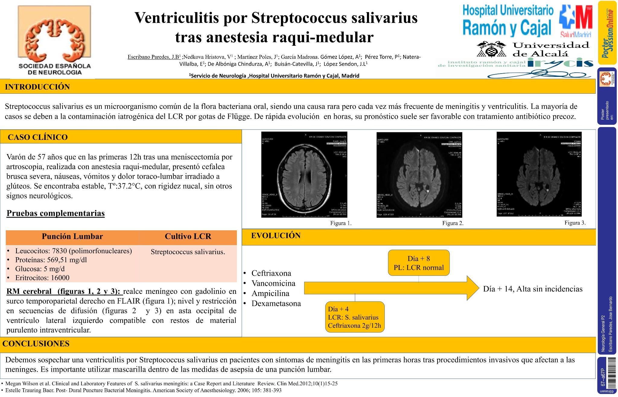 Ventriculitis por Streptococcus salivarius tras anestesia raqui-medular