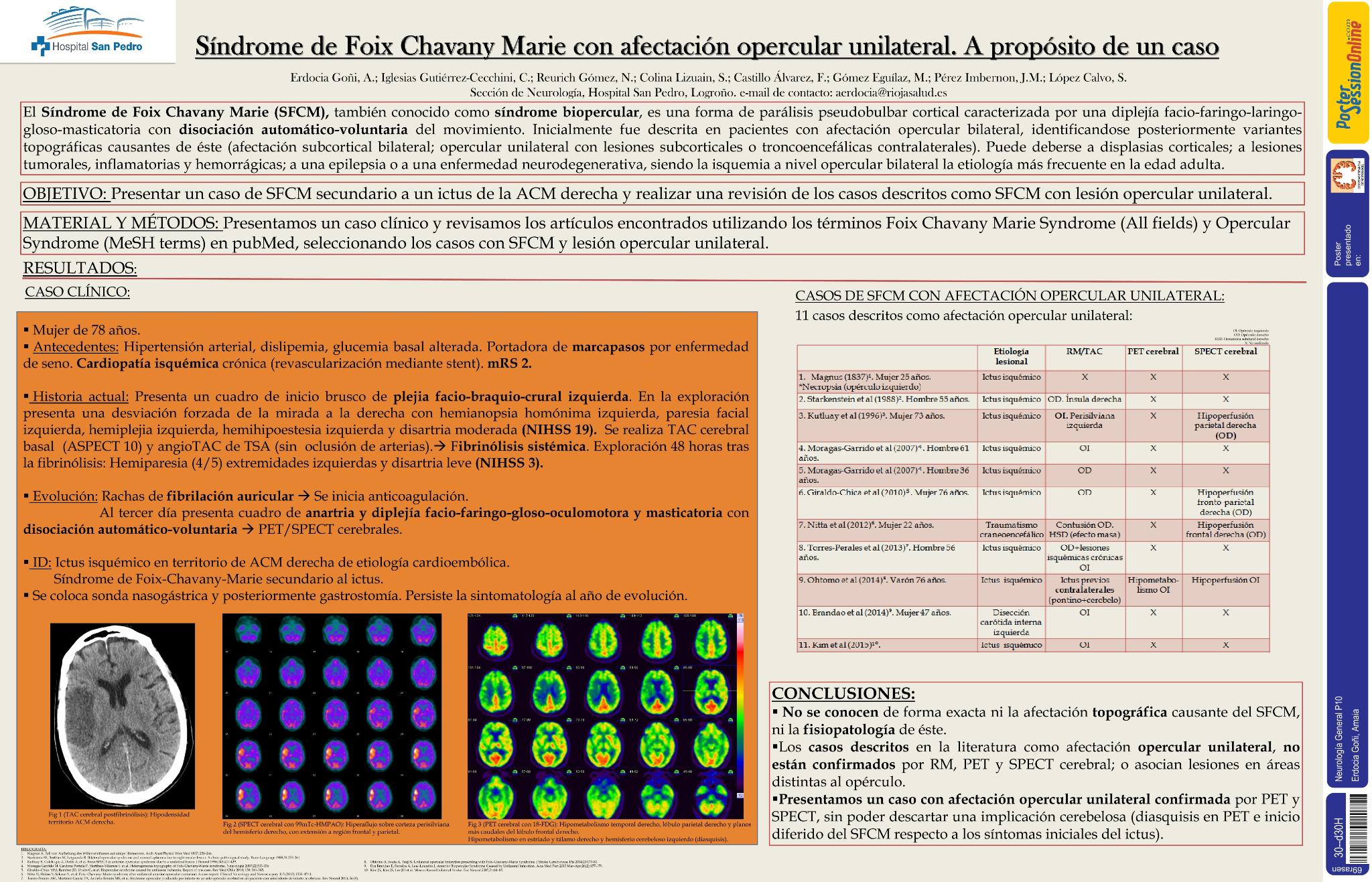 Síndrome de Foix Chavany Marie con afectación opercular unilateral. A propósito de un caso