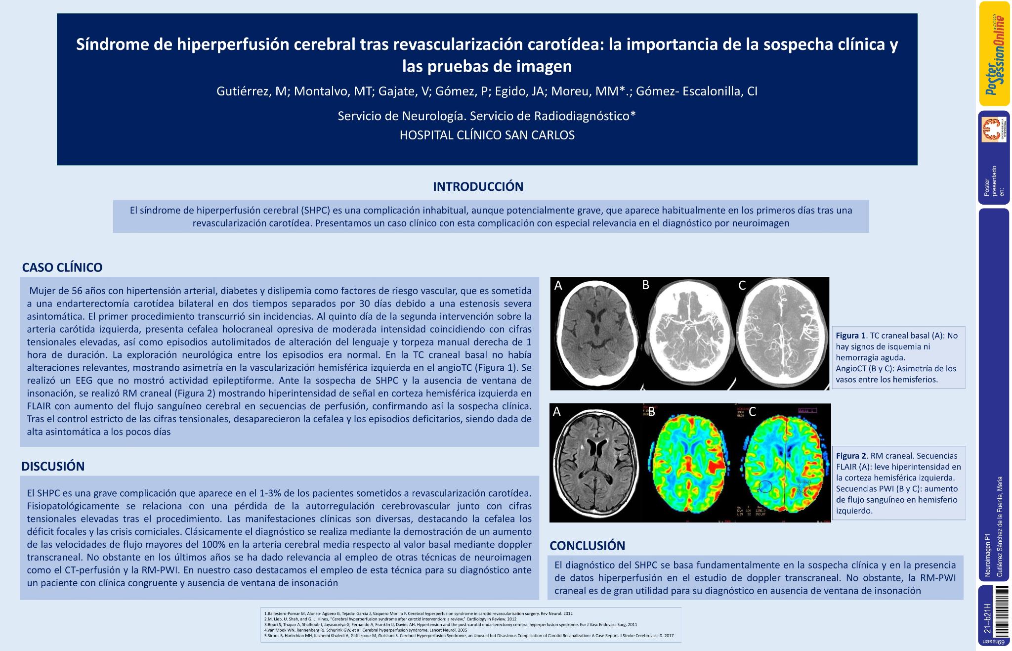 Síndrome de hiperperfusión cerebral: la importancia de la sospecha clínica y las pruebas de imagen