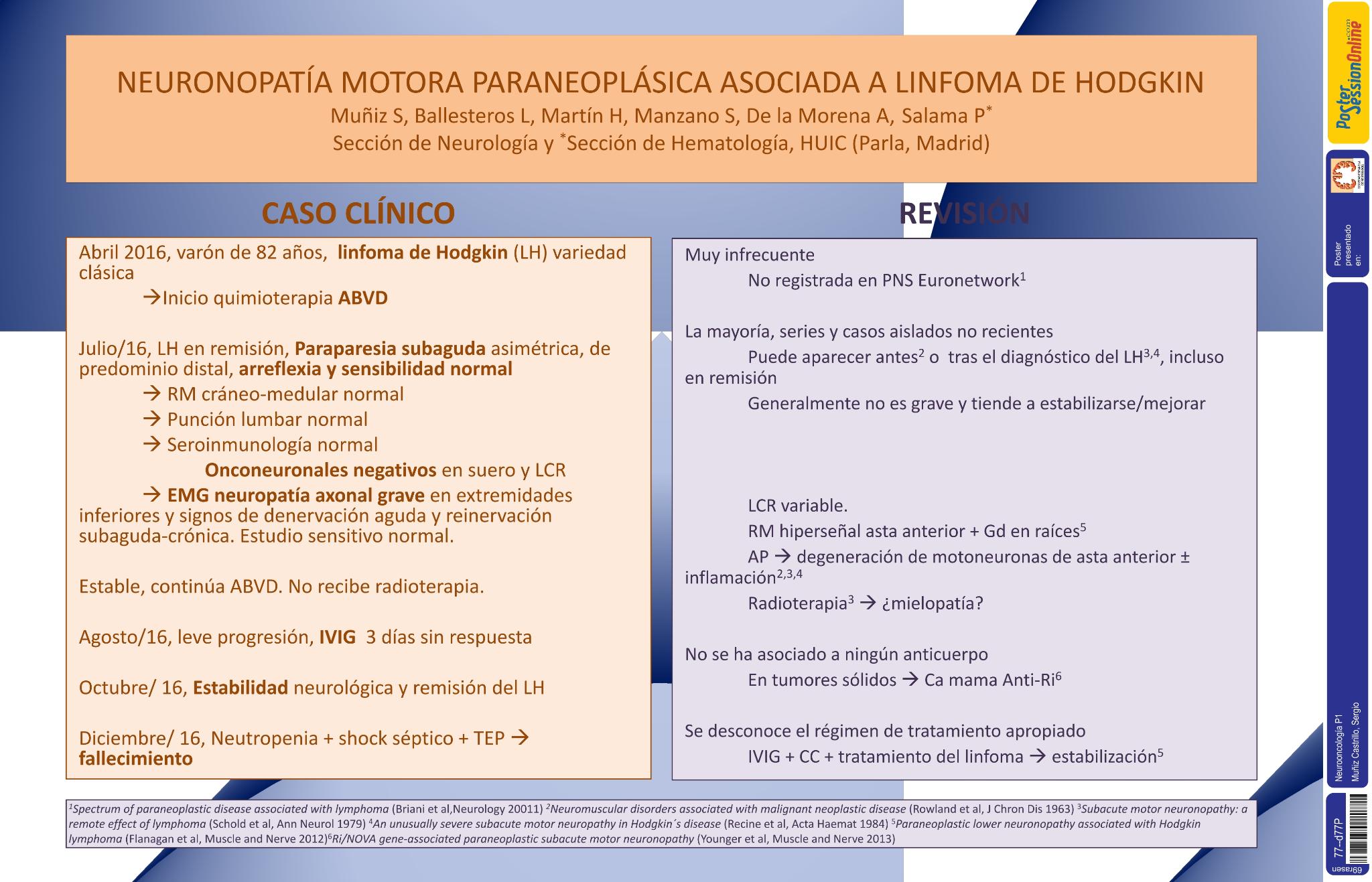 Neuronopatía motora paraneoplásica asociada a linfoma de Hodgkin
