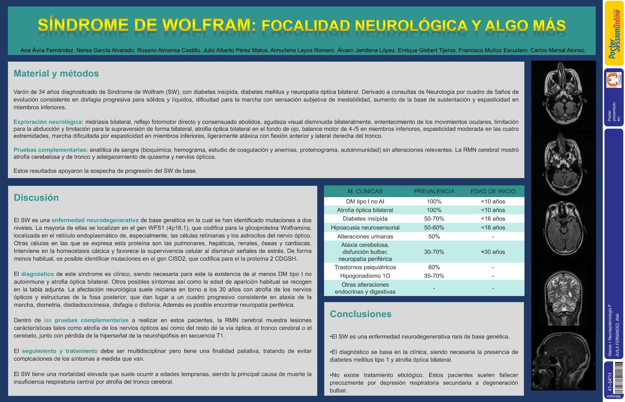 Síndrome de Wolfram: focalidad neurológica y algo más