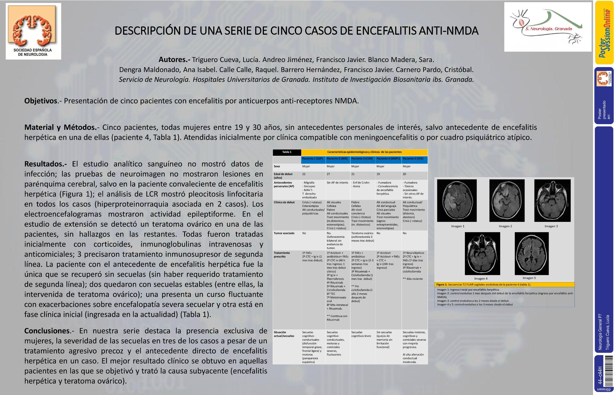 Descripción de una serie de cinco casos de encefalitis anti-NMDA