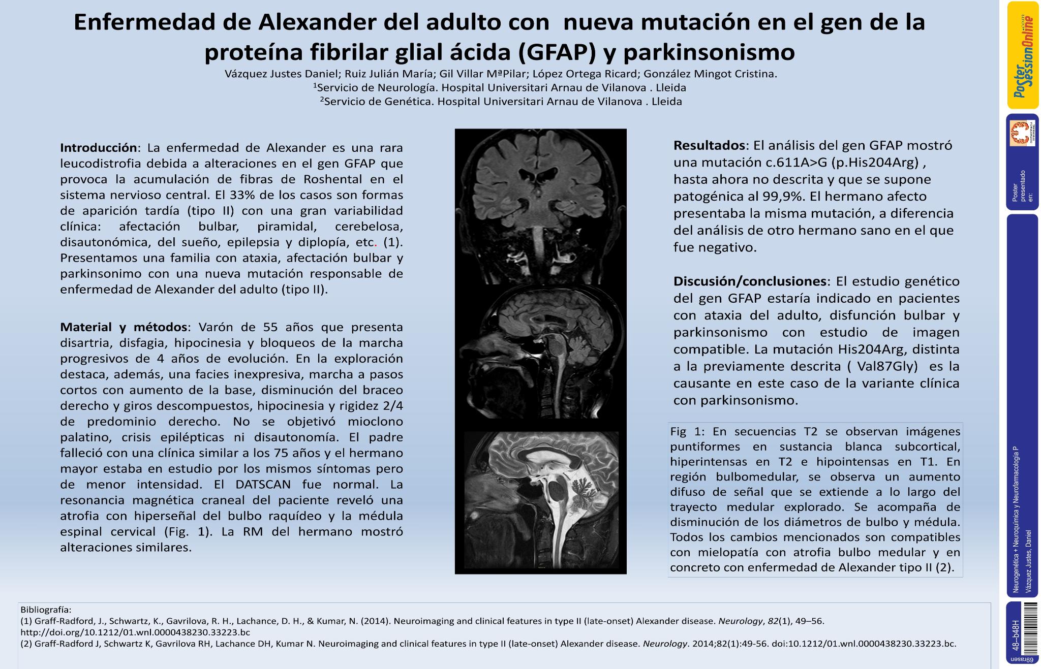 Enfermedad de Alexander del adulto con una nueva mutación en el gen de la proteína fibrilar glial ácida (GFAP) y parkinsonismo