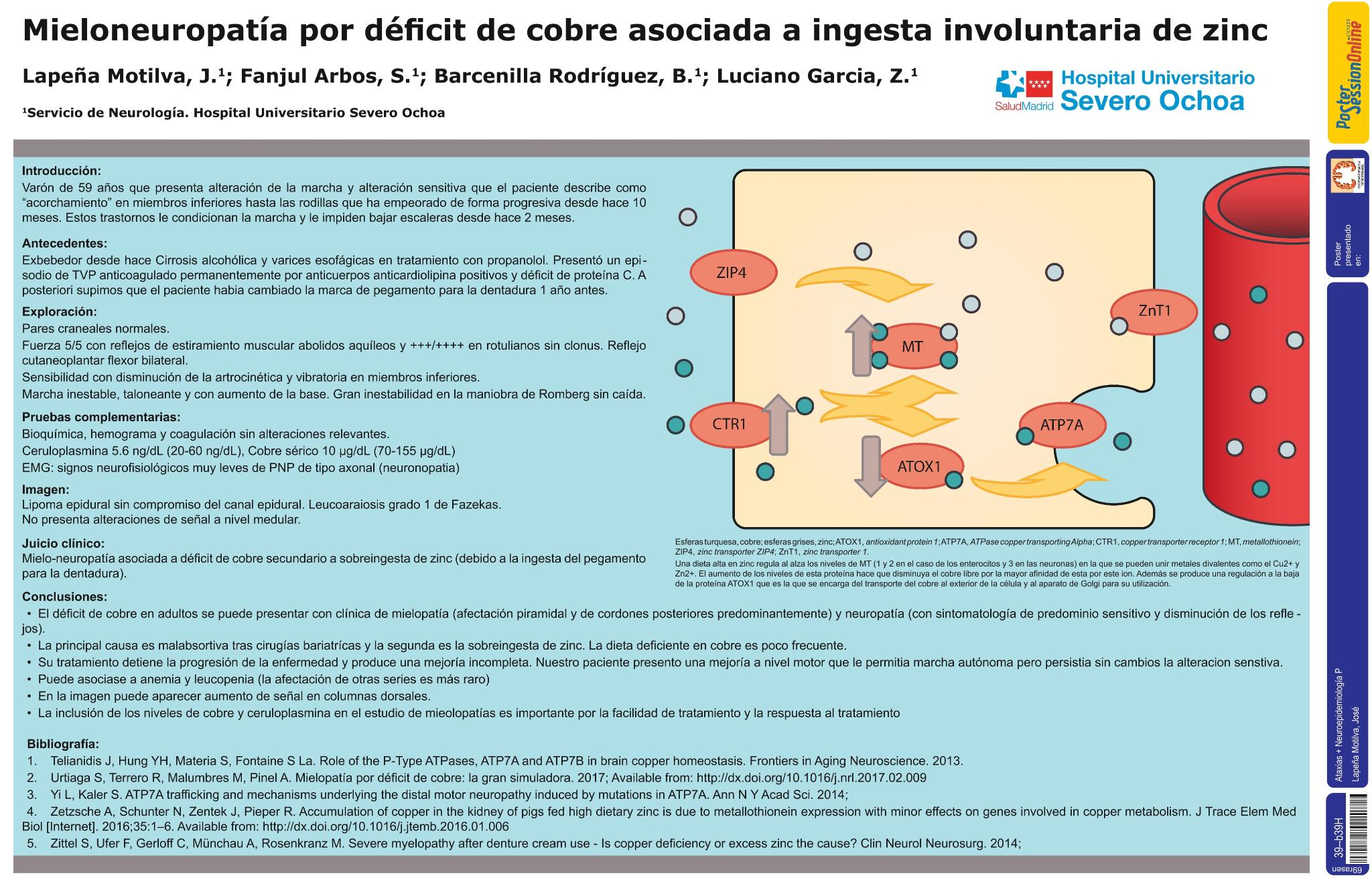 Mieloneuropatía por déficit de cobre asociada a ingesta involuntaria de zinc